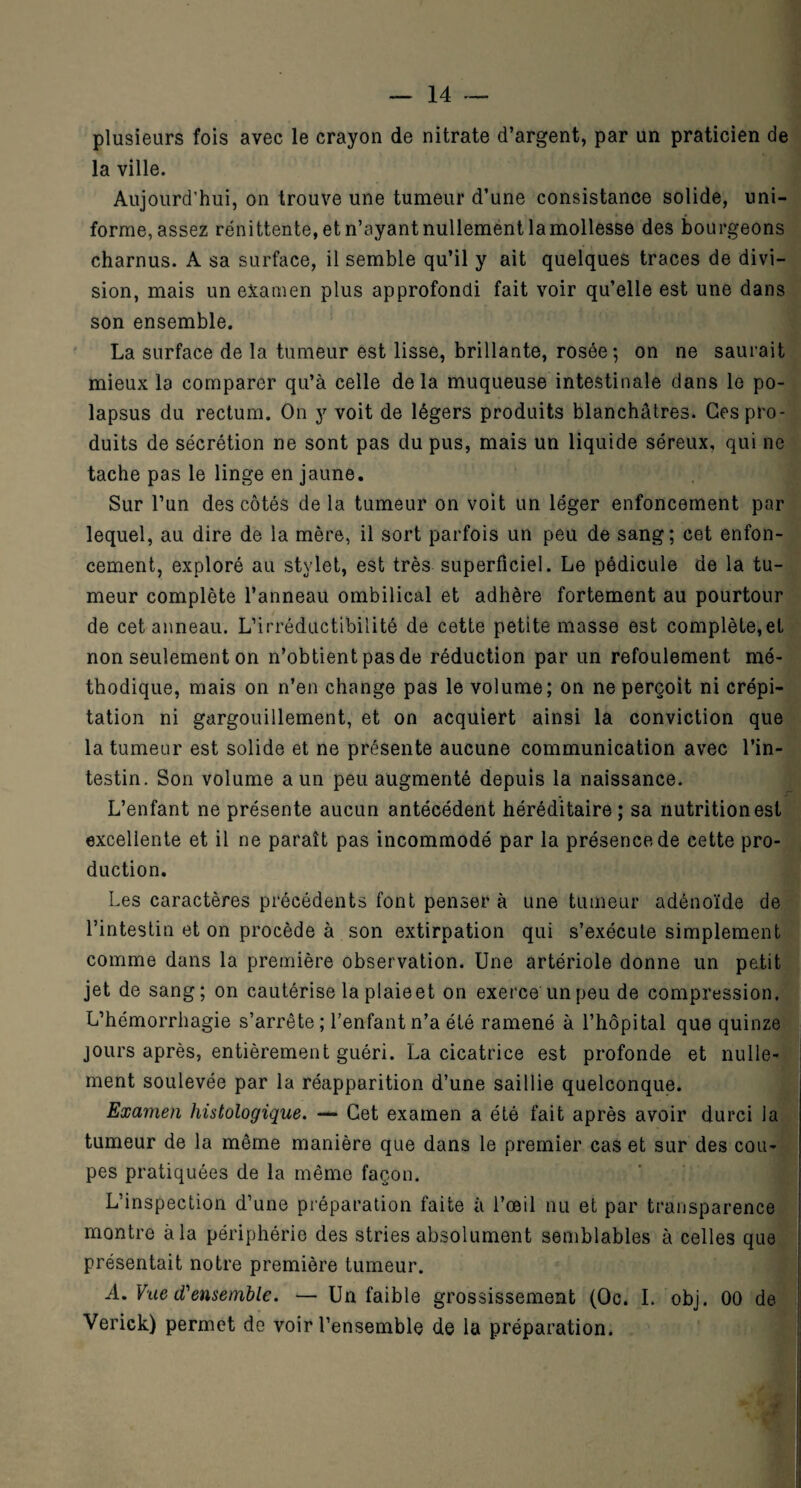 plusieurs fois avec le crayon de nitrate d’argent, par un praticien de la ville. Aujourd’hui, on trouve une tumeur d’une consistance solide, uni¬ forme, assez rénittente, et n’ayant nullement la mollesse des bourgeons charnus. A sa surface, il semble qu’il y ait quelques traces de divi¬ sion, mais un examen plus approfondi fait voir qu’elle est une dans son ensemble. La surface de la tumeur est lisse, brillante, rosée; on ne saurait mieux la comparer qu’à celle delà muqueuse intestinale dans le po- lapsus du rectum. On y voit de légers produits blanchâtres. Ces pro¬ duits de sécrétion ne sont pas du pus, mais un liquide séreux, qui ne tache pas le linge en jaune. Sur l’un des côtés de la tumeur on voit un léger enfoncement par lequel, au dire de la mère, il sort parfois un peu de sang; cet enfon¬ cement, exploré au stylet, est très superficiel. Le pédicule de la tu¬ meur complète l’anneau ombilical et adhère fortement au pourtour de cet anneau. L’irréductibilité de cette petite masse est complètent non seulement on n’obtient pas de réduction par un refoulement mé¬ thodique, mais on n’en change pas le volume; on ne perçoit ni crépi¬ tation ni gargouillement, et on acquiert ainsi la conviction que la tumeur est solide et ne présente aucune communication avec l’in¬ testin. Son volume a un peu augmenté depuis la naissance. L’enfant ne présente aucun antécédent héréditaire; sa nutrition est excellente et il ne paraît pas incommodé par la présence de cette pro¬ duction. Les caractères précédents font penser à une tumeur adénoïde de l’intestin et on procède à son extirpation qui s’exécute simplement comme dans la première observation. Une artériole donne un petit jet de sang; on cautérise la plaie et on exerce un peu de compression. L’hémorrhagie s’arrête; l’enfant n’a été ramené à l’hôpital que quinze jours après, entièrement guéri. La cicatrice est profonde et nulle¬ ment soulevée par la réapparition d’une saillie quelconque. Examen histologique. — Cet examen a été fait après avoir durci la tumeur de la même manière que dans le premier cas et sur des cou¬ pes pratiquées de la même façon. L’inspection d’une préparation faite à l’œil nu et par transparence montre à la périphérie des stries absolument semblables à celles que présentait notre première tumeur. A. Vue lVensemble. — Un faible grossissement (Oc. I. obj. 00 de Verick) permet de voir l’ensemble de la préparation.