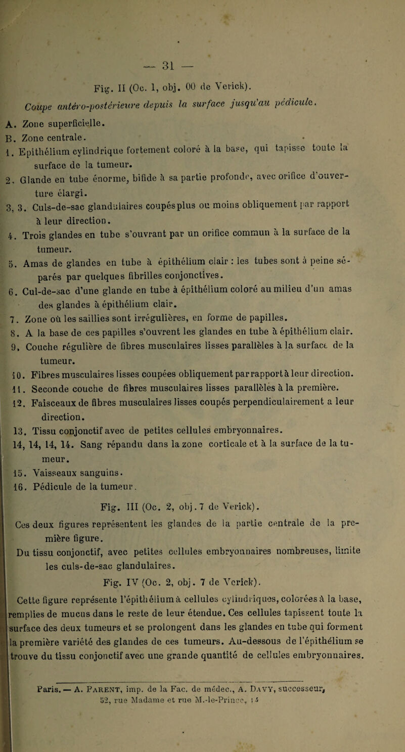 Fig. II (Oc. 1, obj. 00 de Verick). Coupe antéro-postérieure depuis la surface jusqu'au pédicule,. A. Zone superficielle. B. Zone centrale. 1. Epithélium cylindrique fortement coloré à la base, qui tapisse toute la surface de la tumeur. 2. Glande en tube énorme, bifide à sa partie profonde, avec orifice d ouver¬ ture élargi. 3. 3. Culs-de-sac glandulaires coupés plus ou moins obliquement par rapport à leur direction. 4. Trois glandes en tube s’ouvrant par un orifice commun à la surface de la tumeur. 5. Amas de glandes en tube à épithélium clair : les tubes sont a peine sé¬ parés par quelques fibrilles conjonctives. 6. Cul-de-sac d’une glande en tube à épithélium coloré au milieu d’un amas des glandes à épithélium clair. 7. Zone où les saillies sont irrégulières, en forme de papilles. 8. A la base de ces papilles s’ouvrent les glandes en tube ù épithélium clair. 9. Couche régulière de fibres musculaires lisses parallèles à la surface de la tumeur. 10. Fibres musculaires lisses coupées obliquement par rapport à leur direction. 11. Seconde couche de fibres musculaires lisses parallèles à la première. 12. Faisceaux de fibres musculaires lisses coupés perpendiculairement a leur direction. 13. Tissu conjonctif avec de petites cellules embryonnaires. !14, 14, 14, 14. Sang répandu dans la zone corticale et à la surface de la tu¬ meur. 15. Vaisseaux sanguins. 16. Pédicule de la tumeur. Fig. III (Oc. 2, obj. 7 de Verick). Ces deux figures représentent les glandes de la partie centrale de la pre¬ mière figure. Du tissu conjonctif, avec petites cellules embryonnaires nombreuses, limite les culs-de-sac glandulaires. Fig. IV (Oc. 2, obj. 7 de Verick). 1 Cette figure représente l’épithéliumà cellules cylindriques, colorées à la base, remplies de mucus dans le reste de leur étendue. Ces cellules tapissent toute la surface des deux tumeurs et se prolongent dans les glandes en tube qui forment la première variété des glandes de ces tumeurs. Au-dessous de l’épithélium se trouve du tissu conjonctif avec une grande quantité de cellules embryonnaires. Paris. — A. Parent, imp. de la Fac. de médec., A. DavY, successeur, 52, rue Madame et rue M.-le-Prinee, i s