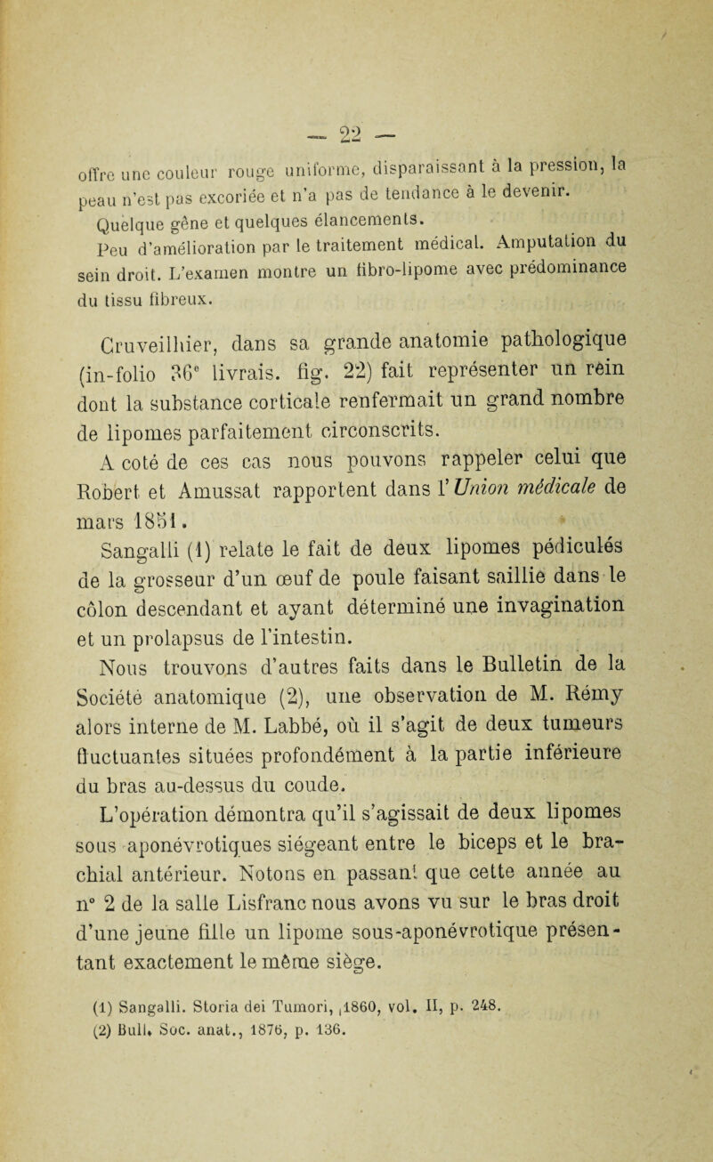 offre une couleur rouge uniforme, disparaissant à la pression, la peau n’est pas excoriée et n’a pas de tendance à le devenir. Quelque gêne et quelques élancements. Peu d’amélioration par le traitement médical. Amputation du sein droit. L’examen montre un tibro-lipome avec prédominance du tissu fibreux. Cruveilhier, dans sa grande anatomie pathologique (in-folio 36e livrais, fig. 22) fait représenter un rèin dont la substance corticale renfermait un grand nombre de lipomes parfaitement circonscrits. A coté de ces cas nous pouvons rappeler celui que Robert et Amussat rapportent dans f Union médicale de mars 18bl. Sangalii (I) relate le fait de deux lipomes pédicules de la grosseur d’un œuf de poule faisant saillie dans le côlon descendant et ayant déterminé une invagination et un prolapsus de l’intestin. Nous trouvons d’autres faits dans le Bulletin de la Société anatomique (2), une observation de M. Rémy alors interne de M. Labbé, où il s’agit de deux tumeurs fluctuantes situées profondément à la partie inférieure du bras au-dessus du coude. L’opération démontra qu’il s’agissait de deux lipomes sous aponévrotiques siégeant entre le biceps et le bra¬ chial antérieur. Notons en passant que cette année au n° 2 de la salle Lisfranc nous avons vu sur le bras droit d’une jeune fille un lipome sous-aponévrotique présen¬ tant exactement le même siège. (1) Sangalii. Storia dei Tumori, ,1860, vol. Il, p. 248.