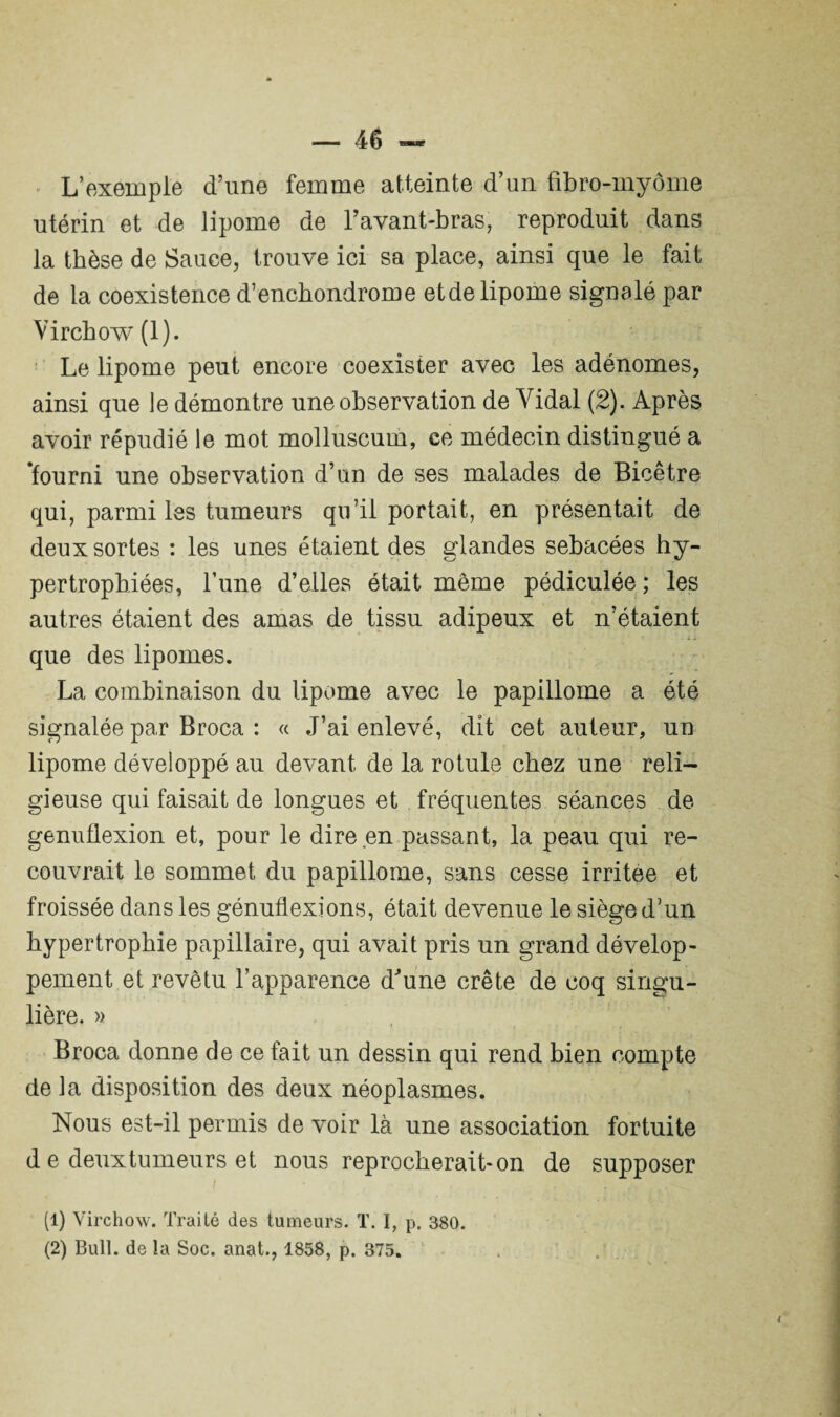 L’exemple d’une femme atteinte d’un fibro-myôme utérin et de lipome de l’avant-bras, reproduit dans la thèse de Sauce, trouve ici sa place, ainsi que le fait de la coexistence d’enchondrome etde lipome signalé par Virchow (1). Le lipome peut encore coexister avec les adénomes, ainsi que le démontre une observation de Vidal (2). Après avoir répudié le mot molluscum, ce médecin distingué a 'fourni une observation d’un de ses malades de Bicêtre qui, parmi les tumeurs qu’il portait, en présentait de deux sortes : les unes étaient des glandes sébacées hy¬ pertrophiées, Lune d’elles était même pédiculée ; les autres étaient des amas de tissu adipeux et n’étaient que des lipomes. La combinaison du lipome avec le papillome a été signalée par Broca : « J’ai enlevé, dit cet auteur, un lipome développé au devant de la rotule chez une reli¬ gieuse qui faisait de longues et fréquentes séances de génuflexion et, pour le dire en passant, la peau qui re¬ couvrait le sommet du papillome, sans cesse irritée et froissée dans les génuflexions, était devenue le siège d’un hypertrophie papillaire, qui avait pris un grand dévelop¬ pement et revêtu l’apparence d'une crête de coq singu¬ lière. » Broca donne de ce fait un dessin qui rend bien compte de la disposition des deux néoplasmes. Nous est-il permis de voir là une association fortuite d e deuxtumeurs et nous reprocherait-on de supposer (1) Virchow. Traité des tumeurs. T. I, p. 380.