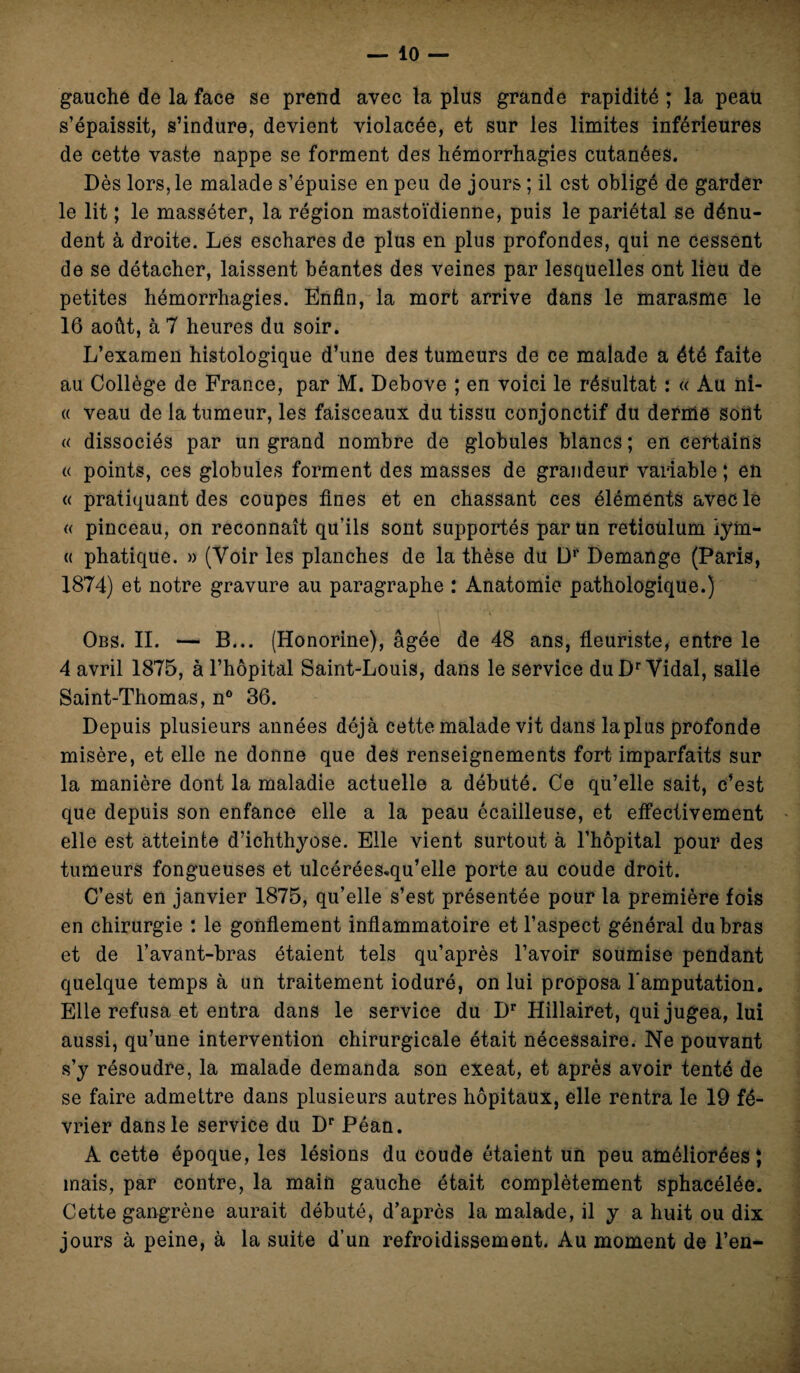 gauche de la face se prend avec la plus grande rapidité ; la peau s’épaissit, s’indure, devient violacée, et sur les limites inférieures de cette vaste nappe se forment des hémorrhagies cutanées. Dès lors, le malade s’épuise en peu de jours ; il est obligé de garder le lit ; le masséter, la région mastoïdienne, puis le pariétal se dénu¬ dent à droite. Les eschares de plus en plus profondes, qui ne cessent de se détacher, laissent béantes des veines par lesquelles ont lieu de petites hémorrhagies. Enfin, la mort arrive dans le marasme le 16 août, à 7 heures du soir. L’examen histologique d’une des tumeurs de ce malade a été faite au Collège de France, par M. Debove ; en voici le résultat : « Au ni- « veau de la tumeur, les faisceaux du tissu conjonctif du derme sont « dissociés par un grand nombre de globules blancs ; en certains « points, ces globules forment des masses de grandeur variable ; en « pratiquant des coupes fines et en chassant ces éléments avec le « pinceau, on reconnaît qu’ils sont supportés par un réticulum iym- « phatique. » (Voir les planches de la thèse du D1' Démangé (Paris, 1874) et notre gravure au paragraphe : Anatomie pathologique.) Obs. IL — B... (Honorine), âgée de 48 ans, fleuriste, entre le 4 avril 1875, à l’hôpital Saint-Louis, dans le service du Dr Vidai, salle Saint-Thomas, n° 36. Depuis plusieurs années déjà cette malade vit dans la plus profonde misère, et elle ne donne que des renseignements fort imparfaits sur la manière dont la maladie actuelle a débuté. Ce qu’elle sait, c’est que depuis son enfance elle a la peau écailleuse, et effectivement elle est atteinte d’ichthyose. Elle vient surtout à l’hôpital pour des tumeurs fongueuses et ulcérées*qu’elle porte au coude droit. C’est en janvier 1875, qu’elle s’est présentée pour la première fois en chirurgie : le gonflement inflammatoire et l’aspect général du bras et de l’avant-bras étaient tels qu’après l’avoir soumise pendant quelque temps à un traitement ioduré, on lui proposa l'amputation. Elle refusa et entra dans le service du Dr Hillairet, qui jugea, lui aussi, qu’une intervention chirurgicale était nécessaire. Ne pouvant s’y résoudre, la malade demanda son exeat, et après avoir tenté de se faire admettre dans plusieurs autres hôpitaux, elle rentra le 19 fé¬ vrier dans le service du Dr Péan. A cette époque, les lésions du coude étaient un peu améliorées} mais, par contre, la main gauche était complètement sphacélée. Cette gangrène aurait débuté, d’après la malade, il y a huit ou dix jours à peine, à la suite d’un refroidissement. Au moment de l’en-