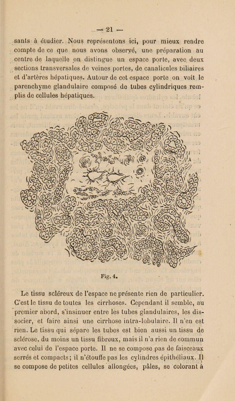 sants à étudier. Nous représentons ici, pour mieux rendre compte de ce que nous avons observé, une préparation au centre de laquelle pn distingue un espace porte, avec, deux sections transversales de veines portes, de canalicules biliaires et d’artères hépatiques. Autour de cet espace porte on voit le parenchyme glandulaire composé de tubes cylindriques rem- plis de cellules hépatiques. ! j ■) Fig. 4. Le tissu scléreux de l’espace ne présente rien de particulier. C’est le tissu de toutes les cirrhoses. Cependant il semble, au premier abord, s’insinuer entre les tubes glandulaires, les dis¬ socier, et faire ainsi une cirrhose intra-lobulaire. Il n’en est rien. Le tissu qui sépare les tubes est bien aussi un tissu de sclérose, du moins un tissu fibreux, mais il n’a rien de commun avec celui de l’espace porte. Il ne se compose pas de faisceaux serrés et compacts; il n’étouffe pas les cylindres épithéliaux. Il , l . ! ) se compose de petites cellules allongées, pâles, se colorant à