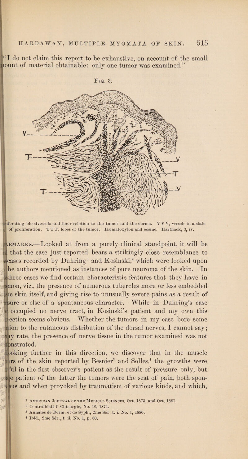 |“I do not claim this report to be exhaustive, on account of the small Jiount of material obtainable: only one tumor was examined.” Fig. 3. Miferating bloodvessels and their relation to the tnmor and the derma. VVY, vessels in a state tj- of proliferation. TTT, lobes of the tumor. Hmmatoxylon and eosine. Hartnack, 3, iv. remarks.—Looked at from a purely clinical standpoint, it will be d that the case just reported bears a strikingly close resemblance to leases recorded by Duhring1 and Kosinski,2 3 which were looked upon t |he authors mentioned as instances of pure neuroma of the skin. In jjthree cases we find certain characteristic features that they have in ilmon, viz., the presence of numerous tubercles more or less embedded “Uie skin itself, and giving rise to unusually severe pains as a result of skure or else of a spontaneous character. While in Duhring’s case | occupied no nerve tract, in Kosinski’s patient and my own this el ection seems obvious. Whether the tumors in my case bore some aion to the cutaneous distribution of the dorsal nerves, I cannot say; jraiy rate, the presence of nerve tissue in the tumor examined was not Hi mstrated. inoking further in this direction, we discover that in the muscle >rs of the skin reported by Besnief* and Solles,4 the growths were ml in the first observer’s patient as the result of pressure only, but fteiiae patient of the latter the tumors were the seat of pain, both spoil- 5 bus and when provoked by traumatism of various kinds, and which, ■ I 1 American Journal of the Medical Sciences, Oct. 1S73, and Oct. 1881. 2 Centralblatt f. Ckirurgie, No. 16, 1874. 3 Annales de Derm, et de Syph., 2me Ser. t. i. No. 1, 1880. 4 Ibid., 2me Ser., t ii. No. 1, p. 60.