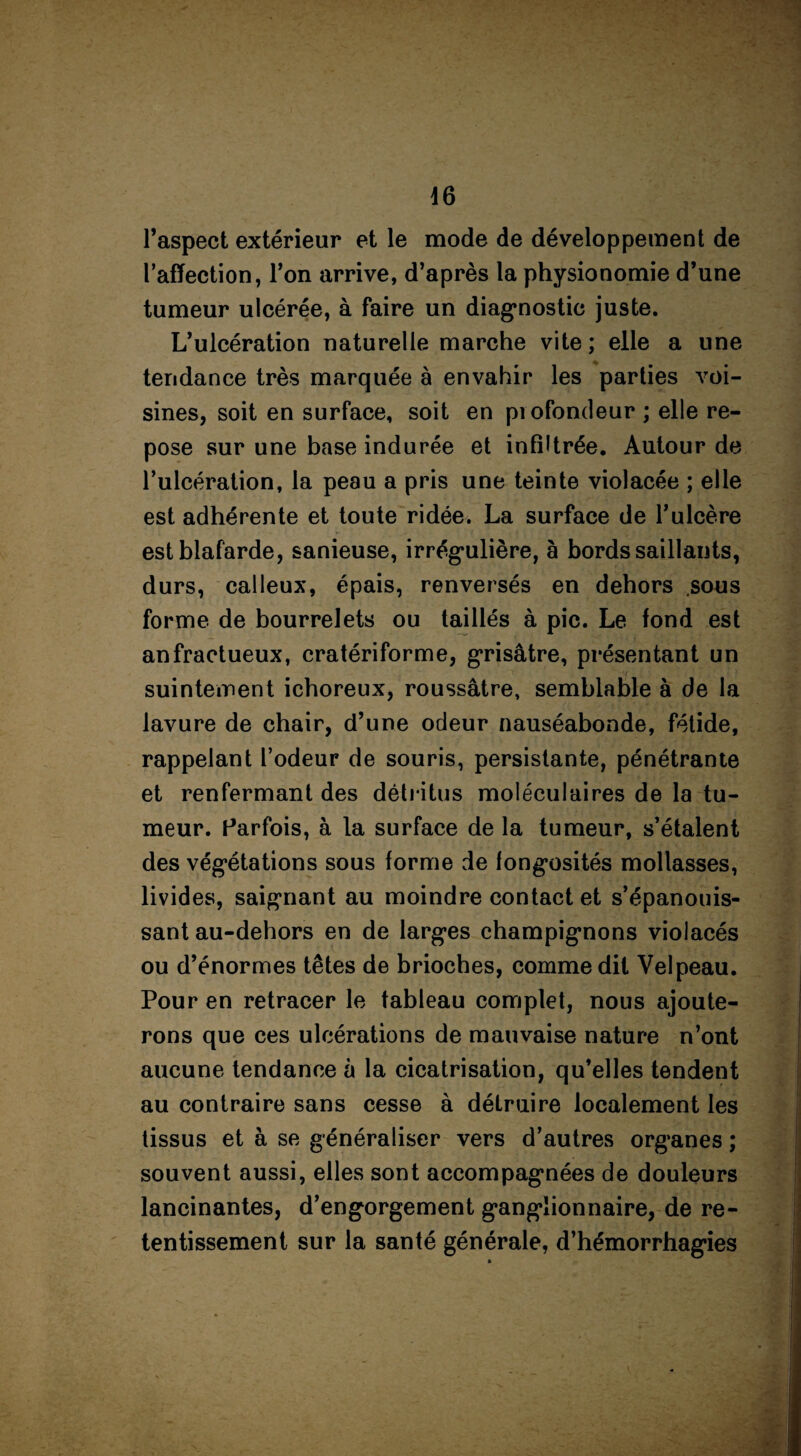 l’aspect extérieur et le mode de développement de l’affection, l’on arrive, d’après la physionomie d’une tumeur ulcérée, à faire un diagnostic juste. L’ulcération naturelle marche vite; elle a une tendance très marquée à envahir les parties voi¬ sines, soit en surface, soit en profondeur ; elle re¬ pose sur une base indurée et infiltrée. Autour de l’ulcération, la peau a pris une teinte violacée ; elle est adhérente et toute ridée. La surface de l’ulcère est blafarde, sanieuse, irrégulière, à bords saillants, durs, calleux, épais, renversés en dehors sous forme de bourrelets ou taillés à pic. Le fond est anfractueux, cratériforme, grisâtre, présentant un suintement ichoreux, roussâtre, semblable à de la lavure de chair, d’une odeur nauséabonde, fétide, rappelant l’odeur de souris, persistante, pénétrante et renfermant des détritus moléculaires de la tu¬ meur. Parfois, à la surface de la tumeur, s’étalent des végétations sous forme de fongosités mollasses, livides, saignant au moindre contact et s’épanouis¬ sant au-dehors en de larges champignons violacés ou d’énormes têtes de brioches, comme dit Velpeau. Pour en retracer le tableau complet, nous ajoute¬ rons que ces ulcérations de mauvaise nature n’ont aucune tendance à la cicatrisation, qu’elles tendent au contraire sans cesse à détruire localement les tissus et à se généraliser vers d’autres organes ; souvent aussi, elles sont accompagnées de douleurs lancinantes, d’engorgement ganglionnaire, de re¬ tentissement sur la santé générale, d’hémorrhagies