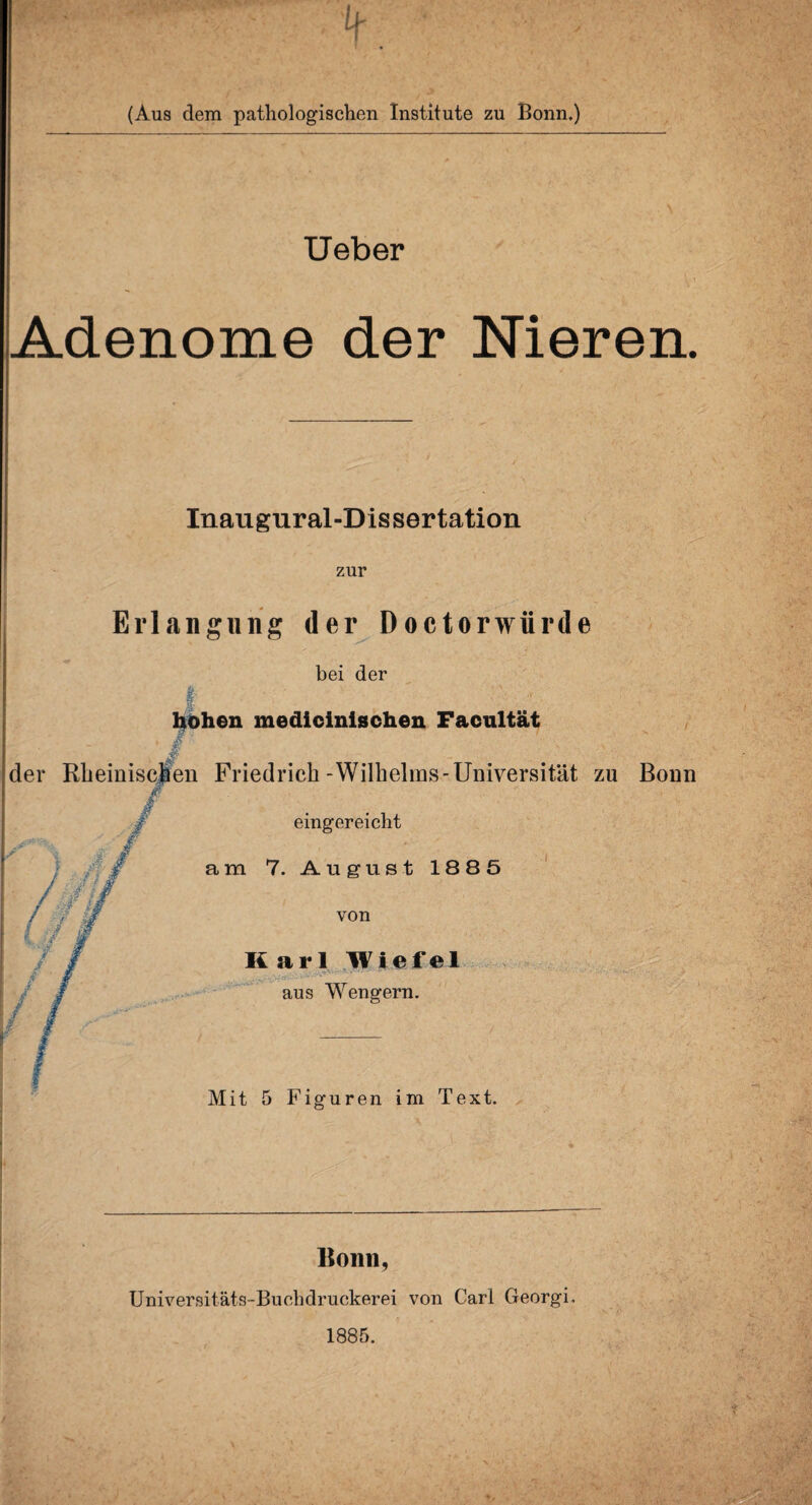 (Aus dem pathologischen Institute zu Bonn.) Ueber Adenome der Nieren. Inaugural-Dissertation zur Erlangung der Doctorwürde bei der f- hohen medicinlschen Facultät •e- der Rheinischen Friedrich-Wilhelms-Universität zu Bonn jj? eingereicht am 7. August 1885 von Karl Wiefel aus Wengern. Mit 5 Figuren im Text. Bonn, Universitäts-Buchdruckerei von Carl Georgi. 1885.