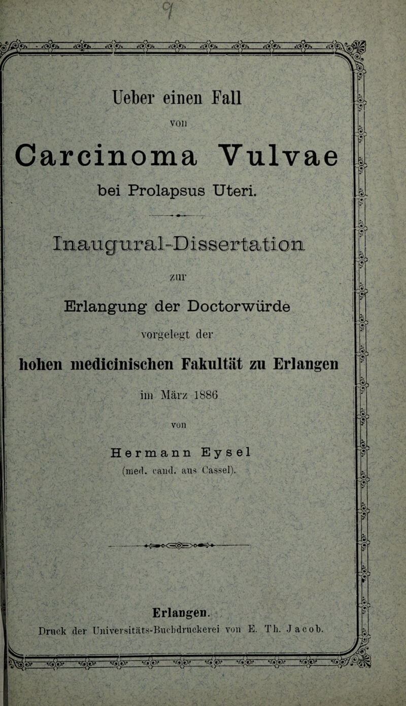 (JA t «5l?iV)h «=(*.(•>» Ä»X«* o . r0 Ueber einen Fall von Carcinoma Vulvae bei Prolapsus Uteri. T*£l - zur Erlangung der Doctorwürde vorgelegt der hohen medicinischen Fakultät zu Erlangen im März 1886 von Hermann Eysel (med. cand. aus Cassel). Erlangen. Druck der Universitäts-Buchdruckerei von E. Th. Jacob. ft 3?