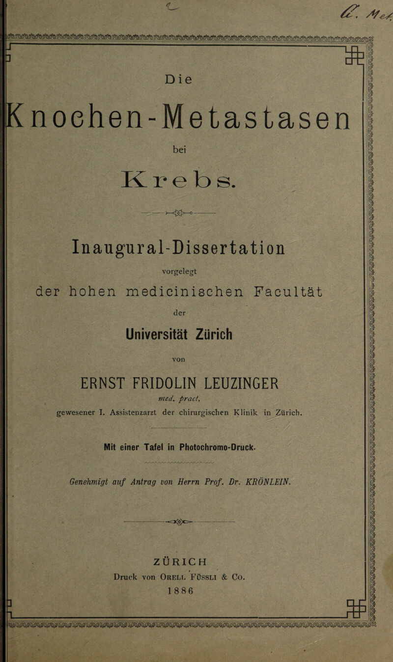 Knoehen-Metastasen bei Krebs ->-<DG>-c— Inaugur al-Dissertation vorgelegt der hohen medicinisehen Faeultät der Universität Zürich von ERNST FRIDOLIN LEUZINGER rned. pract. gewesener I. Assistenzarzt der chirurgischen Klinik in Zürich. Mit einer Tafel in Photochromo-Druck. Genehmigt auf Antrag von Herrn Prof. Dr. KRÖNLEIN. ZÜRICH Druck von Orell Füssli & Co. 1886