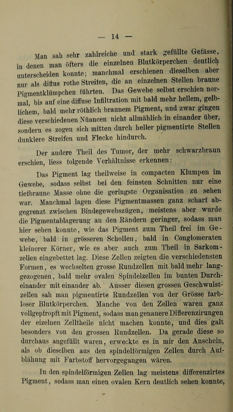 Man sali sehr zahlreiche und stark gefüllte Gefässe, in denen man öfters die einzelnen Blutkörperchen deutlich unterscheiden konnte; manchmal erschienen dieselben aber nur als diffus rothe Streifen, die an einzelnen Stellen braune Pio-mentklümpchen führten. Das Gewebe selbst erschien nor¬ mal bis auf eine diffuse Infiltration mit bald mehr hellem, gelb¬ lichem, bald mehr röthlich braunem Pigment, und zwar gingen diese verschiedenen Niiancen nicht allmählich in einander über, sondern es zogen sich mitten durch heller pigmentirte Steilen dunklere Streifen und Flecke hindurch. Der andere Theil des Tumor, der mehr schwarzbraun erschien, liess folgende Verhältnisse erkennen: Das Pigment lag theilweise in compacten Klumpen im Gewebe, sodass selbst bei den feinsten Schnitten nur eine tiefbraune Masse ohne die geringste Organisation zu sehen war. Manchmal lagen diese Pigmentmassen ganz scharf ab¬ gegrenzt zwischen Bindegewebsziigen, meistens aber wurde die Pigmentablagerung an den Bändern geringer, sodass man hier sehen konnte, wie das Pigment zum Theil frei im Ge¬ webe, bald in grösseren Schollen, bald in Conglomeraten kleinerer Körner, wie es aber auch zum Theil in Sarkom- zellen eingebettet lag. Diese Zellen zeigten die verschiedensten Formen, es wechselten grosse Bundzellen mit bald mehr lang¬ gezogenen , bald mehr ovalen Spindelzellen im bunten Durch¬ einander mit einander ab. Ausser diesen grossen Geschwulst¬ zellen sah man pigmentirte Bundzellen von der Grösse farb¬ loser Blutkörperchen. Manche von den Zellen waren ganz vollgepfropft mit Pigment, sodass man genauere Difterenzirungen der eizelnen Zelltheile nicht machen konnte, und dies galt besonders von den grossen Bundzellen. Da gerade diese so durchaus angefüllt waren, erweckte es in mir den Anschein, als ob dieselben aus den spindelförmigen Zellen durch Auf¬ blähung mit Farbstoff“ hervorgegangen wären. In den spindelförmigen Zellen lag meistens differenzirtes Pigment, sodass man einen ovalen Kern deutlich sehen konnte,