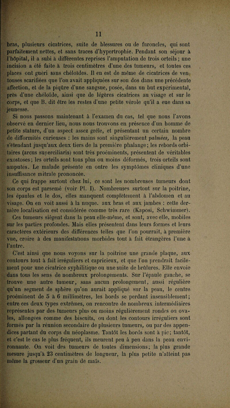 bras, plusieurs cicatrices, suite de blessures ou de furoncles, qui sont parfaitement nettes, et sans traces d’hypertrophie. Pendant son séjour à l’hôpital, il a subi à différentes reprises l’amputation de trois orteils; une incision a été faite à trois centimètres d’une des tumeurs, et toutes ces places ont guéri sans chéloïdes. Il en est de même de cicatrices de ven^ touses scarifiées que l’on avait appliquées sur son dos dans une précédente affection, et de la piqûre d’une sangsue, posée, dans un but expérimental, près d’une chéloïde, ainsi que de légères cicatrices au visage et sur le corps, et que B. dit être les restes d’une petite vérole qu’il a eue dans sa jeunesse. Si nous passons maintenant à l’examen du cas, tel que nous l’avons observé en dernier lieu, nous nous trouvons en présence d’un homme de petite stature, d’un aspect assez grêle, et présentant un certain nombre de difformités curieuses : les mains sont singulièrement palmées, la peau s’étendant jusqu’aux deux tiers de la première phalange; les rebords orbi¬ taires (arcus süperciliaris) sont très proéminents, présentent de véritables exostoses; les orteils sont tous plus ou moins déformés, trois orteils sont amputés. Le malade présente en outre les symptômes cliniques d’une insuffisance mitrale prononcée. Ce qui frappe surtout chez lui, ce sont les nombreuses tumeurs dont son corps est parsemé (voir PI. I). Nombreuses surtout sur la poitrine, les épaules et le dos, elles manquent complètement à l’abdomen et au visage. On en voit aussi à la nuque, aux bras et aux jambes : cette der¬ nière localisation est considérée comme très rare (Kaposi, Schwimmer). Ces tumeurs siègent dans la peau elle-même, et sont, avec elle, mobiles sur les parties profondes. Mais elles présentent dans leurs formes et leurs caractères extérieurs des différences telles que l’on pourrait, à première vue, croire à des manifestations morbides tout à fait étrangères l’une à l’autre. C’est ainsi que nous voyons sur la poitrine une grande plaque, aux contours tout à fait irréguliers et capricieux, et que fon prendrait facile¬ ment pour une cicatrice syphilitique ou une suite de brûlures. Elle envoie dans tous les sens de nombreux prolongements. Sur l’épaule gauche, se trouve une autre tumeur, sans aucun prolongement, aussi régulière qu’un segment de sphère qu’on aurait appliqué sur la peau, le centre proéminent de 5 à 6 millimètres, les bords se perdant insensiblement; entre ces deux types extrêmes, on rencontre de nombreux intermédiaires représentés par des tumeurs plus ou moins régulièrement rondes ou ova¬ les, allongées comme des biscuits, ou dont les contours irréguliers sont formés par la réunion secondaire de plusieurs tumeurs, ou par des appen¬ dices partant du corps du néoplasme. Tantôt les bords sont à pic; tantôt, et c’est le cas le plus fréquent, ils meurent peu à peu dans la peau envi¬ ronnante. On voit des tumeurs de toutes dimensions; la plus grande mesure jusqu’à 23 centimètres de longueur, la plus petite n’atteint pas même la grosseur d’un grain de maïs.