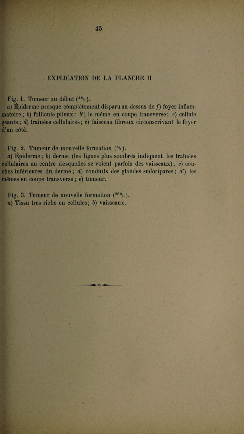 EXPLICATION DE LA PLANCHE II Fig. i. Tumeur au début (35/T). a) Épiderme presque complètement disparu au-dessus de f) foyer inflam¬ matoire; b) follicule pileux; b') le même en coupe transverse; c) cellule géante ; d) traînées cellulaires ; e) faisceau fibreux circonscrivant le foyer d’un côté. Fig. 2. Tumeur de mouvelle formation (6/i). a) Épiderme; b) derme (les lignes plus sombres indiquent les traînées cellulaires au centre desquelles se voient parfois des vaisseaux) ; c) cou¬ ches inférieures du derme; d) conduits des glandes sudoripares; d') les mêmes en coupe transverse ; e) tumeur. Fig. 3. Tumeur de nouvelle formation (660/î). a) Tissu très riche en cellules; b) vaisseaux.