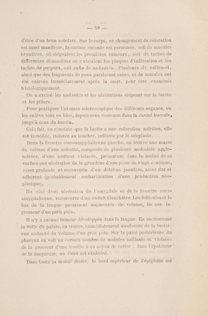 d’être d’un brun noirâtre. Sur le corps, ce changement de coloration est aussi manifeste, la surface cutanée est parsemée, soit de macules brunâtres, où siégeaient les premières tumeurs, soit • de taches de différentes dimensions où existaient les plaques d’infiltration et les taches de purpura, soit enfin de nodosités. Plusieurs de celles-ci, ainsi que des fragments de peau paraissant saine, et de macules ont été enlevés immédiatement après la mort, pour être examinés histologiquement. On a excisé les nodosités et les ulcérations siégeant sur la luette et les piliers. Pour pratiquer l’examen microscopique des différents organes, on les enlève tous en bloc, depuis ceux contenus dans la cavité buccale, jusqu’à ceux du bassin. Cela fait, on constate que la luette a une coloration noirâtre, elle est tuméfiée, indurée au toucher, infiltrée par la néoplasie. Dans la fossette sous-amygdalienne gauche, on trouve une masse du volume d’une noisette, composée de plusieurs nodosités agglo¬ mérées, d’une couleur violacée, présentant dans la moitié de sa surface une ulcération de la grandeur d’une pièce de vingt centimes, assez profonde et recouverte d’un détritus jaunâtre, assez dur et adhérent (probablement eschariûcation d’une production néo¬ plasique) . Du côté droit, ulcération de l’amygdale et de la fossette sous- amygdalienne, recouverte d’un enduit blanchâtre. Les follicules et la bas de la langue paraissent augmentés de volume, ils ont la grosseur d’un petit pois. Il n’y a aucune tumeur développée dans la langue. En sectionnant le voile du palais, on trouve, immédiatement au-dessus de la luette, une nodosité du volume d’un gros pois. Sur la paroi postérieure du pharynx on voit un certain nombre de nodules saillants et violacés de la grosseur d’une lentille à un noyau de cerise ; dans l’épaisseur de la muqueuse, un d’eux est exulcéré. Dans toute sa moitié droite, le bord supérieur de l’épi'glotte est