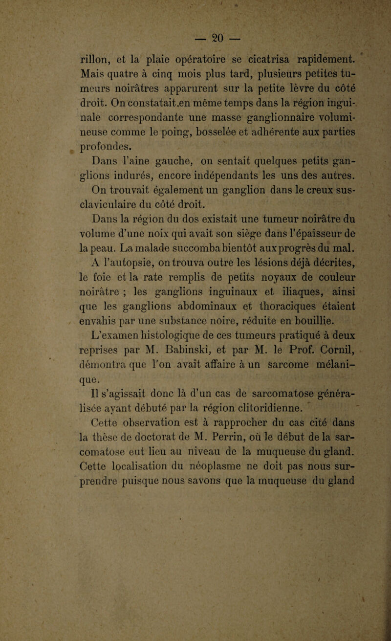 rillon, et la plaie opératoire se cicatrisa rapidement. Mais quatre à cinq mois plus tard, plusieurs petites tu¬ meurs noirâtres apparurent sur la petite lèvre du côté droit. On constatait.en meme temps dans la région ingui¬ nale correspondante une masse ganglionnaire volumi¬ neuse comme le poing, bosselée et adhérente aux parties profondes. Dans l’aine gauche, on sentait quelques petits gan¬ glions indurés, encore indépendants les uns des autres. On trouvait également un ganglion dans le creux sus- claviculaire du côté droit. Dans la région du dos existait une tumeur noirâtre du volume d’une noix qui avait son siège dans l’épaisseur de la peau. La malade succomba bientôt auxprogrèsdu mal. A l’autopsie, on trouva outre les lésions déjà décrites, le foie et la rate remplis de petits noyaux de couleur noirâtre ; les ganglions inguinaux et iliaques, ainsi que les ganglions abdominaux et thoraciques étaient envahis par une substance noire, réduite en bouillie. L’examen histologique de ces tumeurs pratiqué à deux reprises par M. Babinski, et par M. le Prof. Cornil, démontra que l'on avait affaire à un sarcome mélani¬ que. Il s’agissait donc là d’un cas de sarcomatose généra¬ lisée ayant débuté par la région clitoridienne. Cette observation est à rapprocher du cas cité dans la thèse de doctorat de M. Perrin, où le début de la sar¬ comatose eut lieu au niveau de la muqueuse du gland. Cette localisation du néoplasme ne doit pas nous sur¬ prendre puisque nous savons que la muqueuse du gland