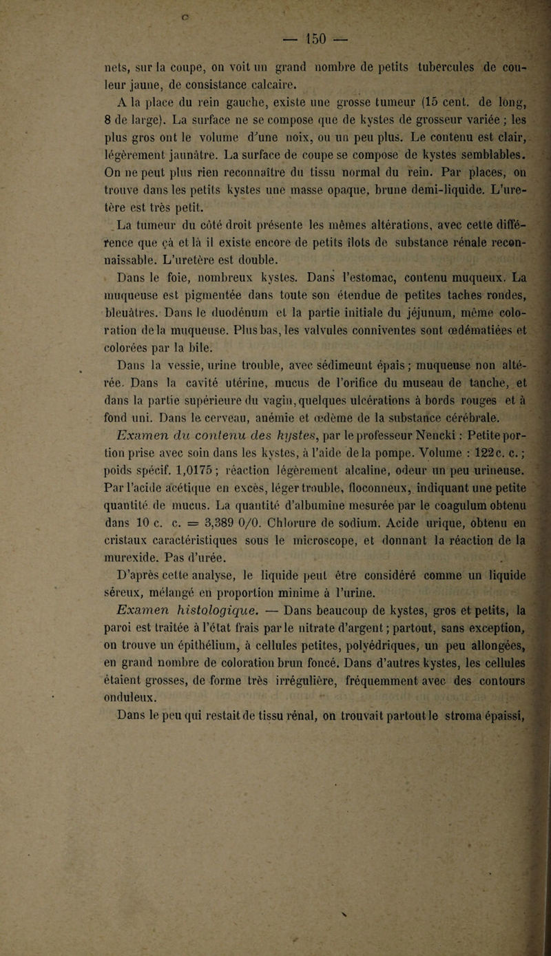 n nets, sur la coupe, on volt un grand nombre de petits tubercules de cou¬ leur jaune, de consistance calcaire. A la place du rein gauche, existe une grosse tumeur (15 cent, de long, 8 de large). La surface ne se compose que de kystes de grosseur variée ; les plus gros ont le volume d^une noix, ou un peu plus. Le contenu est clair, légèrement jaunâtre. La surface de coupe se compose de kystes semblables. On ne peut plus rien reconnaître du tissu normal du rein. Par places, on trouve dans les petits kystes une masse opaque, brune demi-liquide. L’ure¬ tère est très petit. La tumeur du côté droit présente les mêmes altérations, avec cette diffé- rence que çà et là il existe encore de petits îlots de substance rénale recon¬ naissable. L’uretère est double. Dans le foie, nombreux kystes. Dans l’estomac, contenu muqueux. La muqueuse est pigmentée dans toute son étendue de petites taches rondes, bleuâtres. Dans le duodénum et la partie initiale du jéjunum, même colo¬ ration delà muqueuse. Plus bas, les valvules conniventes sont œdématiées et colorées par la bile. Dans la vessie, urine trouble, avec sédimeunt épais ; muqueuse non alté¬ rée. Dans la cavité utérine, mucus de l’orifice du museau de tanche, et dans la partie supérieure du vagin, quelques ulcérations à bords rouges et à fond uni. Dans le cerveau, anémie et œdème de la substance cérébrale. Examen du contenu des kystes, par le professeur Nencki : Petite por¬ tion prise avec soin dans les kystes, à l’aide delà pompe. Volume : 122c. c. ; poids spécif. 1,0175; réaction légèrement alcaline, odeur un peu urineuse. Par l’acide acétique en excès, léger trouble, floconneux, indiquant une petite quantité de mucus. La quantité d’albumine mesurée par le coagulum obtenu dans 10 c. c. = 3,389 0/0. Chlorure de sodium. Acide urique, obtenu en cristaux caractéristiques sous le microscope, et donnant la réaction de la inurexide. Pas d’urée. D’après cette analyse, le liquide peut être considéré comme un liquide séreux, mélangé en proportion minime à l’urine. Examen histologique. — Dans beaucoup de kystes, gros et petits, la paroi est traitée à l’état frais parle nitrate d’argent ; partout, sans exception, on trouve un épithélium, à cellules petites, polyédriques, un peu allongées, en grand nombre de coloration brun foncé. Dans d’autres kystes, les cellules étaient grosses, de forme très irrégulière, fréquemment avec des contours onduleux. Dans le peu qui restait de tissu rénal, on trouvait partout le stroma épaissi, N