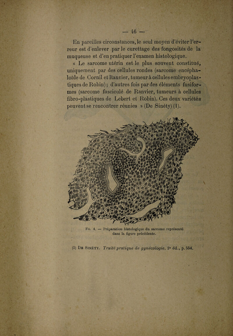 / — 46 — En pareilles circonstances, le seul moyen d’éviter Ter¬ reur est d’enlever par le curettage des fongosités de la muqueuse et d’en pratiquer l’examen histologique. « Le sarcome utérin est le plus souvent constitué, uniquement par des cellules rondes (sarcome encépha- loïde de Cornil et Ranvier, tumeur à cellules embryoplas - tiques de Robin) ; d’autres fois par des éléments fusifor¬ mes (sarcome fasciculé de Ranvier, tumeurs à cellules fibro-plastiques de Lebert et Robin). Ces deux variétés peuvent se rencontrer réunies » (De Sinéty) (1). Fg. 4. — Préparation histologique du sarcome représenté dans la figure précédente. (1) De Sinéty. Traité pratique de gynécologie, 2e éd., p. 554.