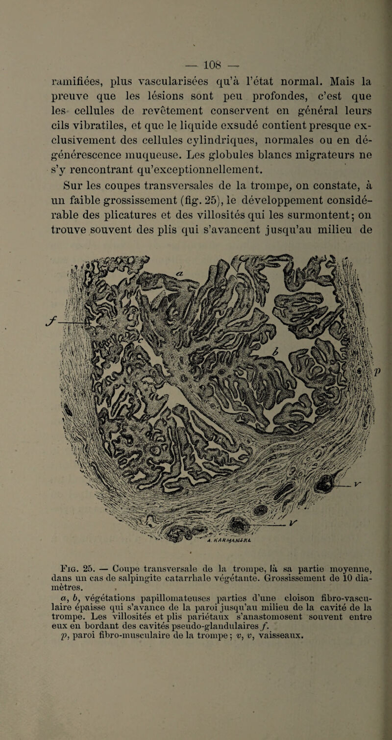 ramifiées, plus vascularisées qu’à l’état normal. Mais la preuve que les lésions sont peu profondes, c’est que les cellules de revêtement conservent en général leurs cils vibratiles, et que le liquide exsudé contient presque ex¬ clusivement des cellules cylindriques, normales ou en dé¬ générescence muqueuse. Les globules blancs migrateurs ne s’y rencontrant qu’exceptionnellement. Sur les coupes transversales de la trompe, on constate, à un faible grossissement (fig. 25), le développement considé¬ rable des plicatures et des villosités qui les surmontent; on trouve souvent des plis qui s’avancent jusqu’au milieu de Fig. 25. — Coupe transversale de la trompe, là sa partie moyenne, dans un cas de salpingite catarrhale végétante. Grossissement de 10 dia¬ mètres. <*, 6, végétations papillomateuses parties d’une cloison fibro-vascu- laire épaisse qui s’avance de la paroi jusqu’au milieu de la cavité de la trompe. Les villosités et plis pariétaux s’anastomosent souvent entre eux en bordant des cavités pseudo-glandulaires f. p, paroi fibro-musculaire de la trompe ; v, v, vaisseaux.