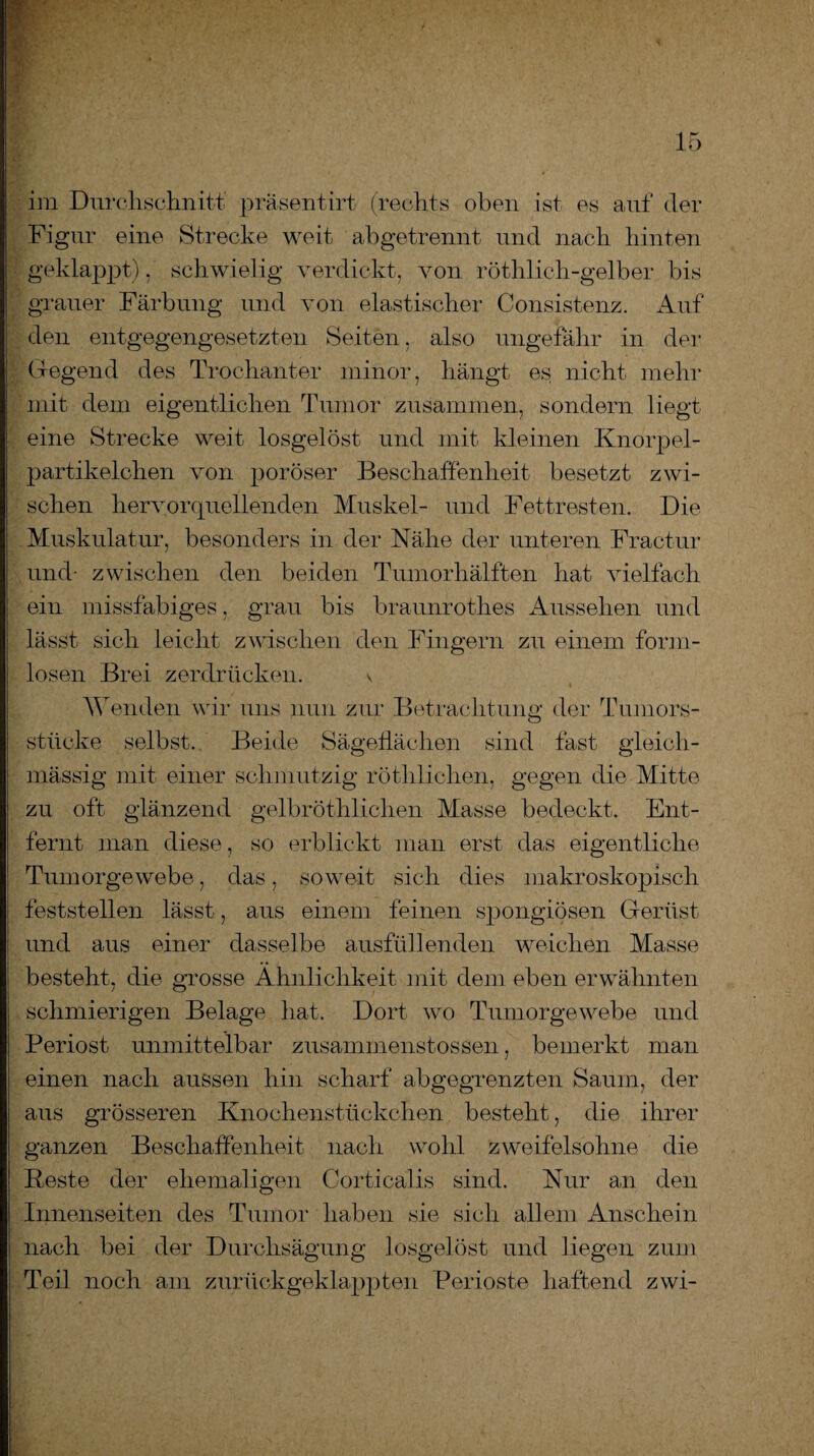 im Durchschnitt präsentirt (rechts oben ist es auf der Figur eine Strecke weit ab getrennt und nach hinten geklappt), schwielig verdickt, von röthlich-gelber bis grauer Färbung und von elastischer Consistenz. Auf den entgegengesetzten Seiten, also ungefähr in der Gegend des Trochanter minor, hängt es nicht mehr mit dem eigentlichen Tumor zusammen, sondern liegt eine Strecke weit losgelöst und mit kleinen Knorpel¬ partikelchen von poröser Beschaffenheit besetzt zwi¬ schen hervorquellenden Muskel- und Fettresten. Die Muskulatur, besonders in der Nähe der unteren Fractur und- zwischen den beiden Tumorhälften hat vielfach ein missfabiges, grau bis braunrothes Aussehen und lässt sich leicht zwischen den Fingern zu einem form¬ losen Brei zerdrücken. \ Wenden wir uns nun zur Betrachtung der Tumors¬ stücke selbst. Beide Sägeflächen sind fast gleich- mässig mit einer schmutzig röthlichen, gegen die Mitte zu oft glänzend gelbröthlichen Masse bedeckt. Ent¬ fernt man diese, so erblickt man erst das eigentliche Tumorgewebe, das, soweit sich dies makroskopisch feststellen lässt, aus einem feinen spongiösen Gerüst und aus einer dasselbe ausfüllenden weichen Masse besteht, die grosse Ähnlichkeit mit dem eben erwähnten schmierigen Belage hat. Dort wo Tumorgewebe und Periost unmittelbar zusammenstossen, bemerkt man einen nach aussen hin scharf abgegrenzten Saum, der aus grösseren Knochenstückchen besteht, die ihrer ganzen Beschaffenheit nach wohl zweifelsohne die Beste der ehemaligen Corticalis sind. Nur an den Innenseiten des Tumor haben sie sich allem Anschein nach bei der Durclisägung losgelöst und liegen zum Teil noch am zurückgeklappten Perioste haftend zwi-