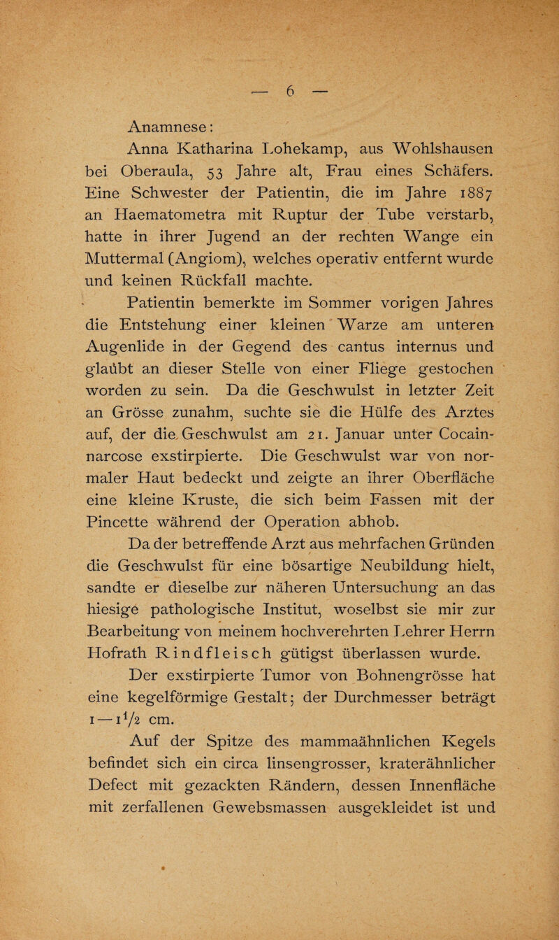 Anamnese: Anna Katharina Lohekamp, aus Wohlshausen bei Oberaula, 53 Jahre alt, Frau eines Schäfers. Eine Schwester der Patientin, die im Jahre 1887 an Haematometra mit Ruptur der Tube verstarb, hatte in ihrer Jugend an der rechten Wange ein Muttermal (Angiom), welches operativ entfernt wurde und keinen Rückfall machte. Patientin bemerkte im Sommer vorigen Jahres die Entstehung einer kleinen Warze am unteren Augenlide in der Gegend des cantus internus und glaübt an dieser Stelle von einer Fliege gestochen worden zu sein. Da die Geschwulst in letzter Zeit an Grösse zunahm, suchte sie die Hülfe des Arztes auf, der die, Geschwulst am 21. Januar unter Cocain- narcose exstirpierte. Die Geschwulst war von nor¬ maler Haut bedeckt und zeigte an ihrer Oberfläche eine kleine Kruste, die sich beim Fassen mit der Pincette während der Operation abhob. Da der betreffende Arzt aus mehrfachen Gründen die Geschwulst für eine bösartige Neubildung hielt, sandte er dieselbe zur näheren Untersuchung an das hiesige pathologische Institut, woselbst sie mir zur Bearbeitung von meinem hochverehrten Lehrer Herrn Hofrath Rindfleisch gütigst überlassen wurde. Der exstirpierte Tumor von Bohnengrösse hat eine kegelförmige Gestalt; der Durchmesser beträgt 1 — U/2 cm. Auf der Spitze des mammaähnlichen Kegels befindet sich ein circa linsengrosser, kraterähnlicher Defect mit gezackten Rändern, dessen Innenfläche mit zerfallenen Gewebsmassen ausgekleidet ist und