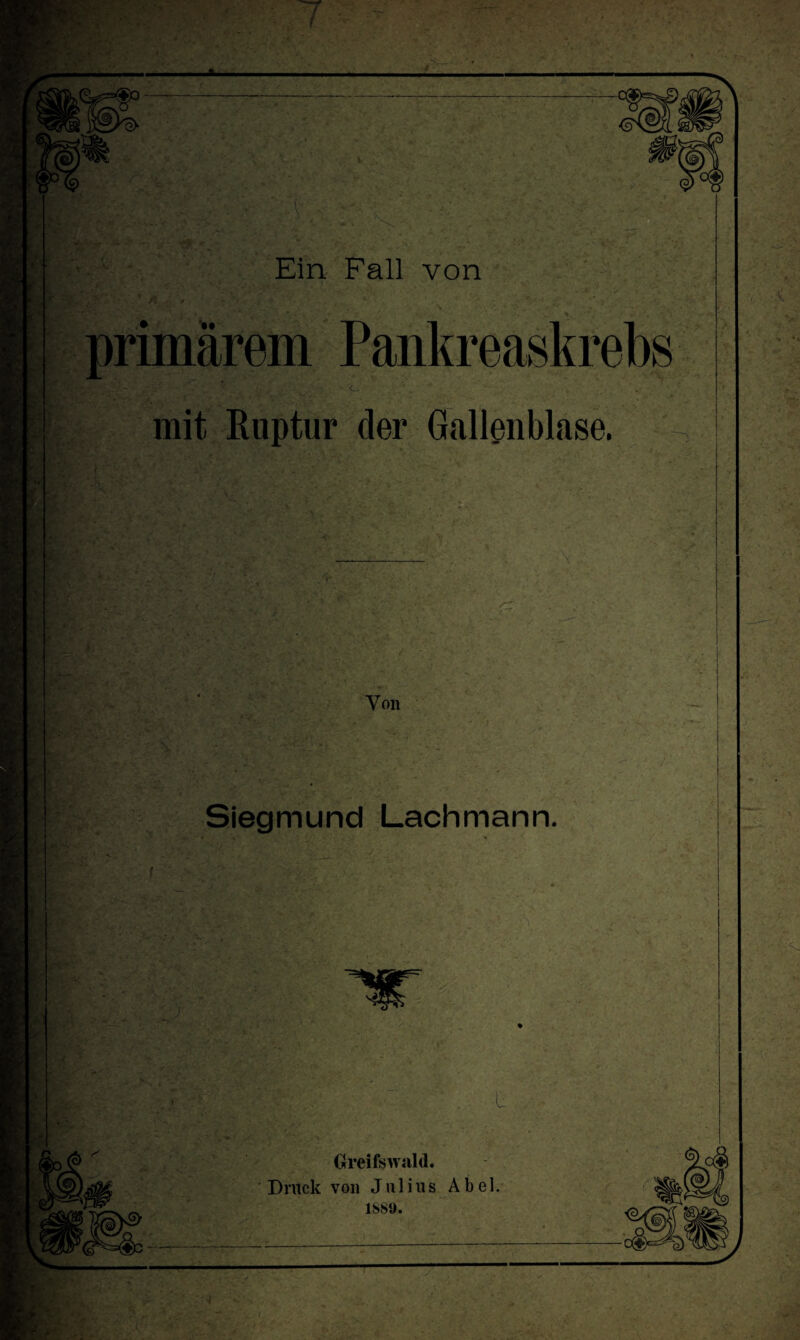 BTn <■ * , Ein Fall von * /. primärem Pankreaskrebs & ; I ^1© mit Ruptur der Gallenblase. Von Siegmund Lachmann. Greifswald. Druck von Julius Abel. 1SS9.