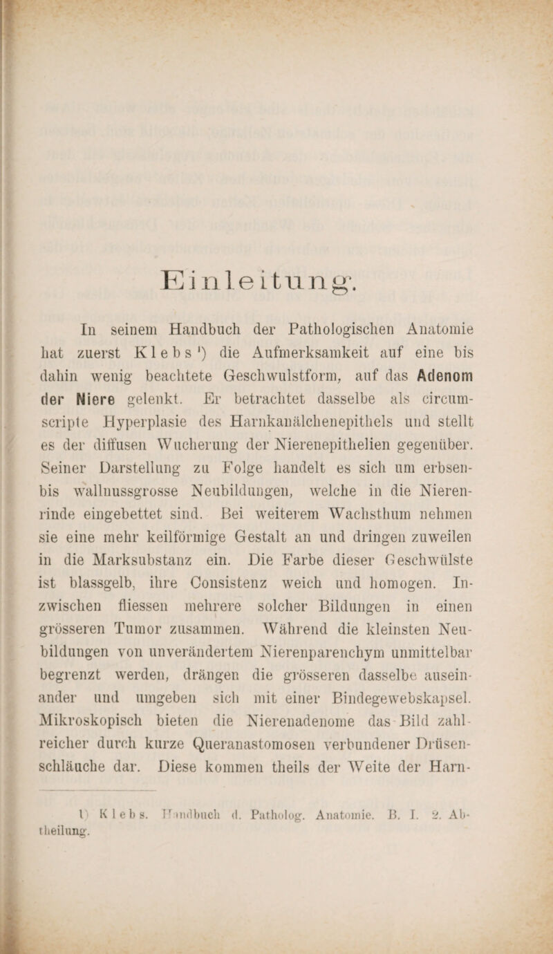 In seinem Handbuch der Pathologischen Anatomie hat zuerst K1 e b s *) die Aufmerksamkeit auf eine bis dahin wenig beachtete Geschwulstform, auf das Adenom der Niere gelenkt. Er betrachtet dasselbe als circum- scripte Hyperplasie des Harnkanälchenepithels und stellt es der diffusen Wucherung der Nierenepithelien gegenüber. Seiner Darstellung zu Folge handelt es sich um erbsen- bis wallnussgrosse Neubildungen, welche in die Nieren¬ rinde eingebettet sind. Bei weiterem Wachsthum nehmen sie eine mehr keilförmige Gestalt an und dringen zuweilen in die Marksubstanz ein. Die Farbe dieser Geschwülste ist blassgelb, ihre Consistenz weich und homogen. In¬ zwischen fliessen mehrere solcher Bildungen in einen grösseren Tumor zusammen. Während die kleinsten Neu¬ bildungen von unverändertem Nierenparenchym unmittelbar begrenzt werden, drängen die grösseren dasselbe ausein¬ ander und umgeben sich mit einer Bindegewebskapsel. Mikroskopisch bieten die Nierenadenome das Bild zahl¬ reicher durch kurze Queranastomosen verbundener Drüsen¬ schläuche dar. Diese kommen theils der Weite der Harn- 1) K 1 eb s. f'mdbucli d. Patholog. Anatomie. B. I. 2. Ab¬ teilung-.