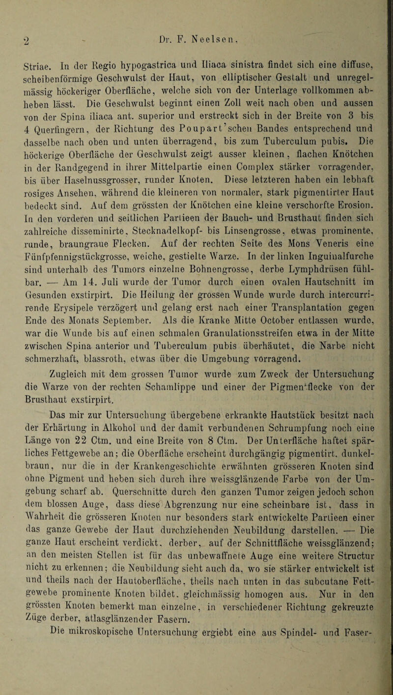 Dr. F. Ne eisen. 9 Li Striae. In der Regio hypogastrica und Iliaca sinistra findet sich eine diffuse, scheibenförmige Geschwulst der Haut, von elliptischer Gestalt und unregel¬ mässig höckeriger Oberfläche, welche sich von der Unterlage vollkommen ab¬ heben lässt. Die Geschwulst beginnt einen Zoll weit nach oben und aussen von der Spina iliaca ant. superior und erstreckt sich in der Breite von 3 bis 4 Querfingern, der Richtung des Poupart’scheu Bandes entsprechend und dasselbe nach oben und unten überragend, bis zum Tuberculum pubis. Die höckerige Oberfläche der Geschwulst zeigt ausser kleinen, flachen Knötchen in der Randgegend in ihrer Mittelpartie einen Complex stärker vorragender, bis über Haselnussgrosser, runder Knoten. Diese letzteren haben ein lebhaft rosiges Ansehen, während die kleineren von normaler, stark pigmentirter Haut bedeckt sind. Auf dem grössten der Knötchen eine kleine verschorfte Erosion. In den vorderen und seitlichen Parlieen der Bauch- und Brusthaut finden sich zahlreiche disseminirte, Stecknadelkopf- bis Linsengrosse, etwas prominente, runde, braungraue Flecken. Auf der rechten Seite des Mons Yeneris eine Fünfpfennigstückgrosse, weiche, gestielte Warze. In der linken Inguinalfurche sind unterhalb des Tumors einzelne Bohnengrosse, derbe Lymphdrüsen fühl¬ bar. -— Am 14. Juli wurde der Tumor durch einen ovalen Hautschnitt im Gesunden exstirpirt. Die Heilung der grossen Wunde wurde durch intercurri- rende Erysipele verzögert und gelang erst nach einer Transplantation gegen Ende des Monats September. Als die Kranke Mitte October entlassen wurde, war die Wunde bis auf einen schmalen Granulationsstreifen etwa in der Mitte zwischen Spina anterior und Tuberculum pubis überhäutet, die Narbe nicht schmerzhaft, blassroth, etwas über die Umgebung vorragend. Zugleich mit dem grossen Tumor wurde zum Zweck der Untersuchung die Warze von der rechten Schamlippe und einer der Pigmenfflecke von der Brusthaut exstirpirt. Das mir zur Untersuchung übergebene erkrankte Hautstück besitzt nach der Erhärtung in Alkohol und der damit verbundenen Schrumpfung noch eine Länge von 22 Ctm. und eine Breite von 8 Ctm. Der Unterfläche haftet spär¬ liches Fettgewebe an; die Oberfläche erscheint durchgängig pigmentirt, dunkel¬ braun, nur die in der Krankengeschichte erwähnten grösseren Knoten sind ohne Pigment und heben sich durch ihre weissglänzende Farbe von der Um¬ gebung scharf ab. Querschnitte durch den ganzen Tumor zeigen jedoch schon dem blossen Auge, dass diese Abgrenzung nur eine scheinbare ist, dass in Wahrheit die grösseren Knoten nur besonders stark entwickelte Parlieen einer das ganze Gewebe der Haut durchziehenden Neubildung darstellen. — Die ganze Haut erscheint verdickt, derber, auf der Schnittfläche weissglänzend; an den meisten Stellen ist für das unbewaffnete Auge eine weitere Structur nicht zu erkennen; die Neubildung sieht auch da, wo sie stärker entwickelt ist und theils nach der Hautoberfläche, theils nach unten in das subcutane Fett¬ gewebe prominente Knoten bildet, gleichmässig homogen aus. Nur in den grössten Knoten bemerkt man einzelne, in verschiedener Richtung gekreuzte Züge derber, atlasglänzender Fasern. Die mikroskopische Untersuchung ergiebt eine aus Spindel- und Faser-