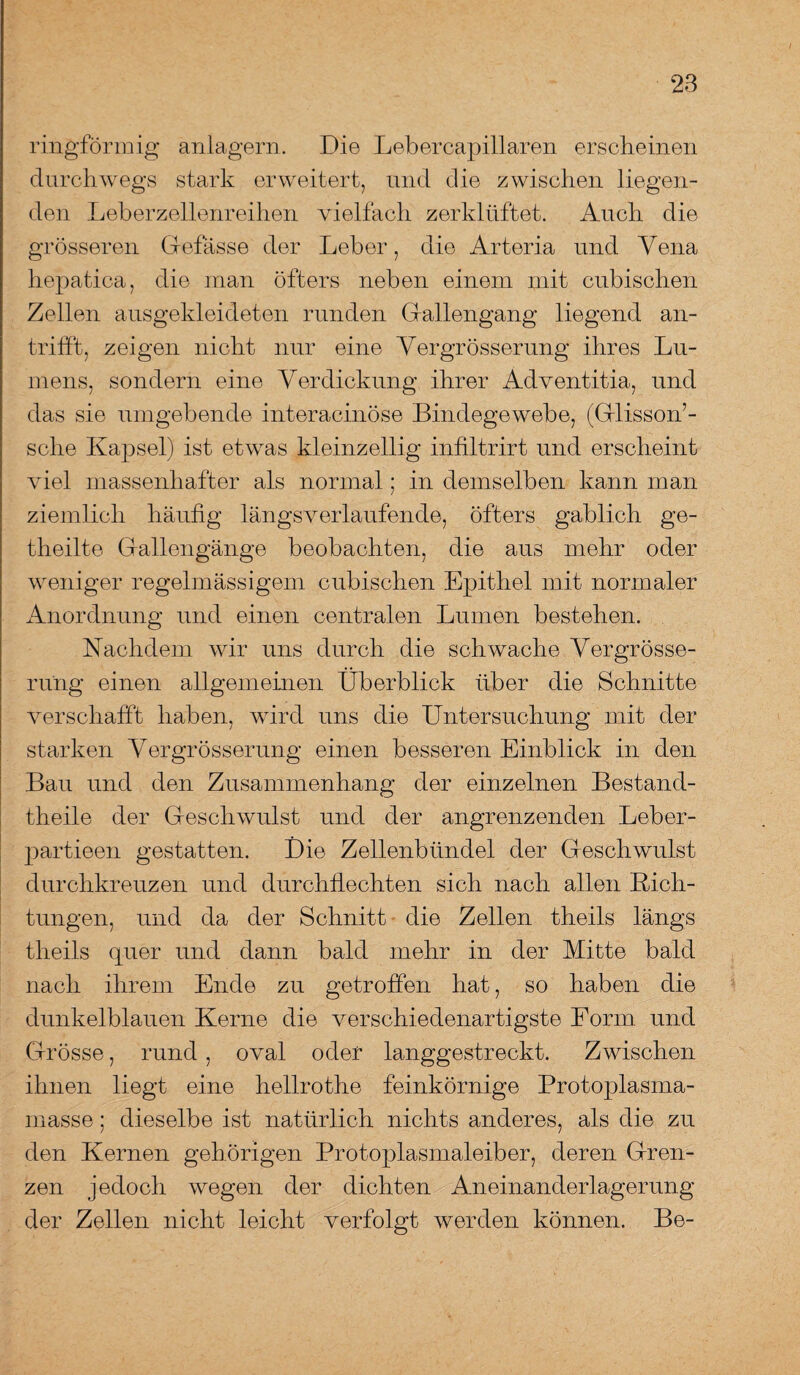 ringförmig anlagern. Die Lebercapillaren erscheinen durchwegs stark erweitert, und die zwischen liegen¬ den Leberzellenreihen vielfach zerklüftet. Auch die grösseren Gefasse der Leber, die Arteria und Vena hepatica, die man öfters neben einem mit cubisehen Zellen ausgekleideten runden Gallengang liegend an¬ trifft, zeigen nicht nur eine Yergrösserung ihres Lu¬ mens, sondern eine Verdickung ihrer Adventitia, und das sie umgebende interacinöse Bindegewebe, (Glisson’- sche Kapsel) ist etwas kleinzellig iniiltrirt und erscheint viel massenhafter als normal; in demselben kann man ziemlich häufig längsverlaufende, öfters gablich ge- theilte Gallengänge beobachten, die aus mehr oder weniger regelmässigem cubischen Epithel mit normaler Anordnung und einen centralen Lumen bestehen. Nachdem wir uns durch die schwache Vergrösse- rung einen allgemeinen Überblick über die Schnitte verschafft haben, wird uns die Untersuchung mit der starken Yergrösserung einen besseren Einblick in den Bau und den Zusammenhang der einzelnen Bestand¬ teile der Geschwulst und der angrenzenden Leber- partieen gestatten. Die Zellenbündel der Geschwulst durchkreuzen und durchflechten sich nach allen Rich¬ tungen, und da der Schnitt die Zellen theils längs theils quer und dann bald mehr in der Mitte bald nach ihrem Ende zu getroffen hat, so haben die dunkelblauen Kerne die verschiedenartigste Form und Grösse, rund, oval oder langgestreckt. Zwischen ihnen liegt eine hellrothe feinkörnige Protoplasma¬ masse ; dieselbe ist natürlich nichts anderes, als die zu den Kernen gehörigen Protoplasmaleiber, deren Gren¬ zen jedoch wegen der dichten Aneinanderlagerung der Zellen nicht leicht verfolgt werden können. Be-