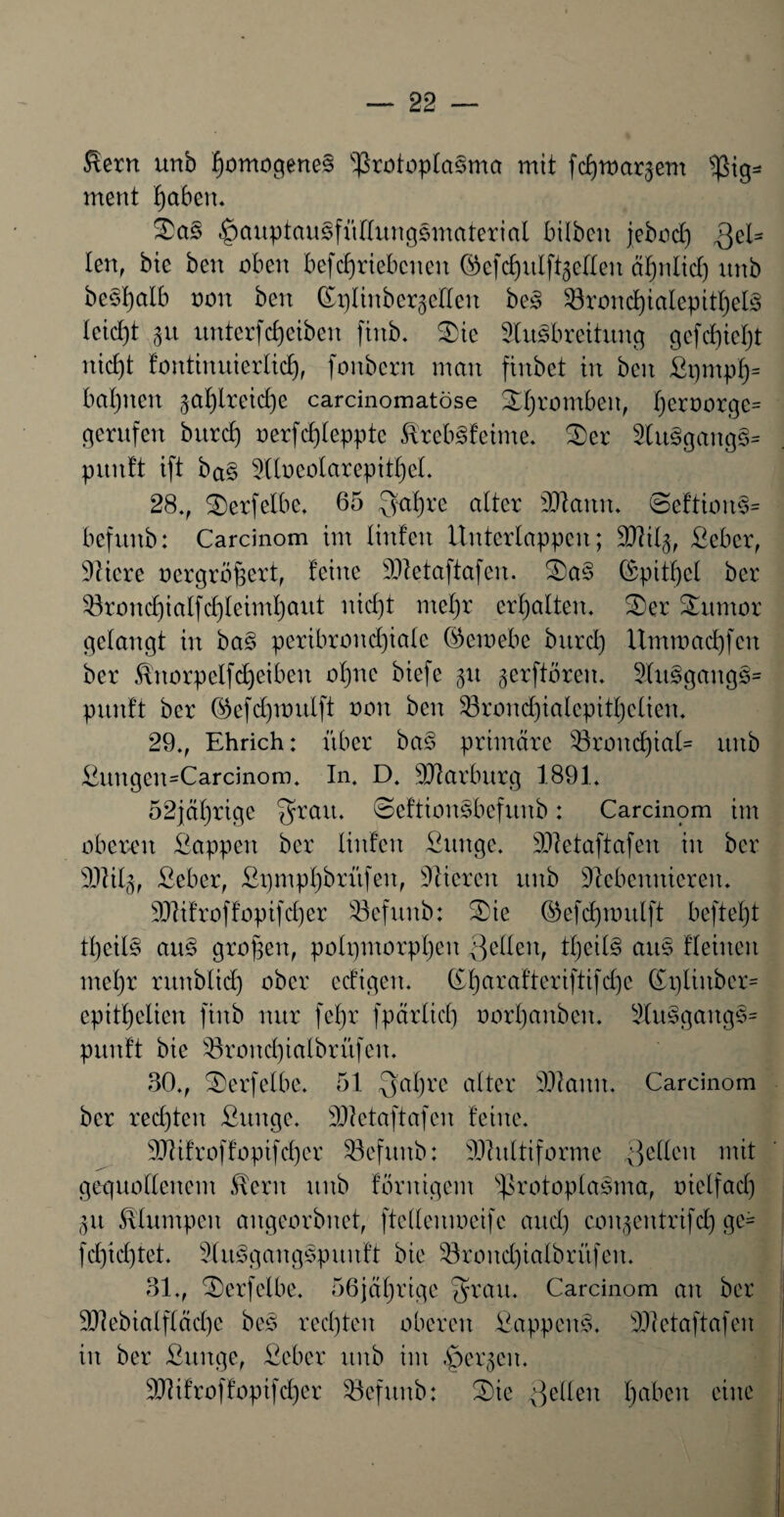 föerrt urtb §omogene§ Protoplasma mit fcfprar-jem Pig* ment f)aben. Sa§ <£)auptausfüllungsmaterial bilbeu jebod) 3C^ len, bie ben oben betriebenen ©efdjulftgellen äfjnlid) unb beSljalb non ben (^pünbergelten beS Prond)ialcpitl)el3 Icidjt gtt unterf cf) eiben fittb. Sie Ausbreitung gefd)iel)t nid)t fontinuicrlid), fonbcrn man fiitbet in beit ßpmpf)= bahnen §al)ireicf)e carcinomatöse Strombett, I)croorge= gerufen burcf) oerfcf)leppte ÄrebSfeime. Ser 5lu§gang§- pitutt ift bas Aloeolarepitfjel. 28., Serfetbe. 65 Qafyre alter 3Jlann. @eftiort§= bcfitnb: Carcinom im linfen itnterlappcn; Nltlg, ßebcr, Niere oergrö^ert, feine Nletaftafen. Sa§ ©pitfjel ber 33rond)ialfd)lcimf)aut nid)t mel)r erhalten. Ser Junior gelangt in ba§ peribrond)ialc ©emebe bitrd) Ummad)fcn ber fönorpelfdjeiben ofjnc biefe §n gerftören. AuSgang§= pitnft ber ©efcfynmlft non ben Prond)ialepitl)clicn. 29., Ehrich: über baS primäre $3rond)ial= unb &ungen=Carcinom. In. D. Niarlntrg 1891. 52jäl)rigc fjfrau. SeftionSbcfunb: Carcinom im oberen Pappen ber linfen Äuttgc. NIetaftafen in ber 9Nil§, ßeber, Pt)mpf)brüfen, Nieren unb Nebennieren. Nlifroffopifcfyer Pefunb: Sie ©efcfymulft beftefjt tl)cilS au§ großen, polqmorpljen Qcllen, tljcilS aus flehten mel)r runblid) ober edigert. (£l)arafteriftifd)c ©plinbcr= cpitl)elien finb nur fel)r fpärlid) oorl)anben. Au§gangs= puuft bie 33rond)ialbrüfen. 30., Serfetbe. 51 Qaljrc alter Nlanit. Carcinom ber rechten Punge. Nfctaftafen feine. NUfroffopifd)er Pefunb: Nluttiforme gellen mit gequollenem $ern unb förnigent Protoplasma, oielfad) <$u klumpen angeorbnet, ftellenmeifc and) coujentrifcf) ge= fd)id)tet. AitSgangSpunft bie Prond)iatbritfen. 31., ^Derfelbe. 56jährige ^rau. Carcinom an ber 9Nebialfläd)c bes redeten oberen Wappens. Nletaftafen in ber Punge, Peber unb im bergen. SJlifroffopifdjer SBefunb: Sie gelten Ijabcn eine