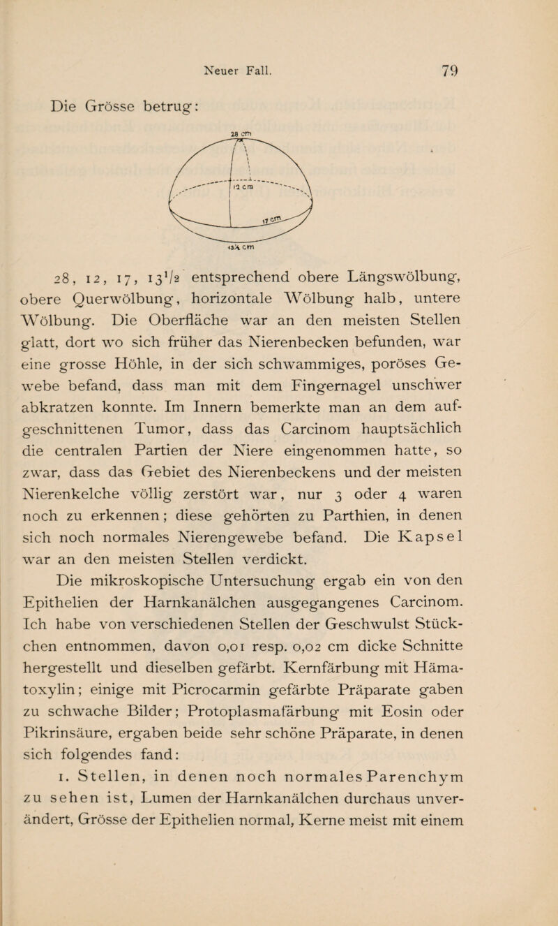 Die Grösse betrug: 28 cm cm 28, 12, 17, 13V2 entsprechend obere Längswölbung, obere Querwölbung, horizontale Wölbung halb, untere Wölbung. Die Oberfläche war an den meisten Stellen glatt, dort wo sich früher das Nierenbecken befunden, war eine grosse Höhle, in der sich schwammiges, poröses Ge¬ webe befand, dass man mit dem Fingernagel unschwer abkratzen konnte. Im Innern bemerkte man an dem auf¬ geschnittenen Tumor, dass das Carcinom hauptsächlich die centralen Partien der Niere eingenommen hatte, so zwar, dass das Gebiet des Nierenbeckens und der meisten Nierenkelche völlig zerstört war, nur 3 oder 4 waren noch zu erkennen; diese gehörten zu Parthien, in denen sich noch normales Nierengewebe befand. Die Kapsel war an den meisten Stellen verdickt. Die mikroskopische Untersuchung ergab ein von den Epithelien der Harnkanälchen ausgegangenes Carcinom. Ich habe von verschiedenen Stellen der Geschwulst Stück¬ chen entnommen, davon 0,01 resp. 0,02 cm dicke Schnitte hergestellt und dieselben gefärbt. Kernfärbung mit Häma- toxylin; einige mit Picrocarmin gefärbte Präparate gaben zu schwache Bilder; Protoplasmafärbung mit Eosin oder Pikrinsäure, ergaben beide sehr schöne Präparate, in denen sich folgendes fand: 1. Stellen, in denen noch normales Parenchym zu sehen ist, Lumen der Harnkanälchen durchaus unver¬ ändert, Grösse der Epithelien normal, Kerne meist mit einem