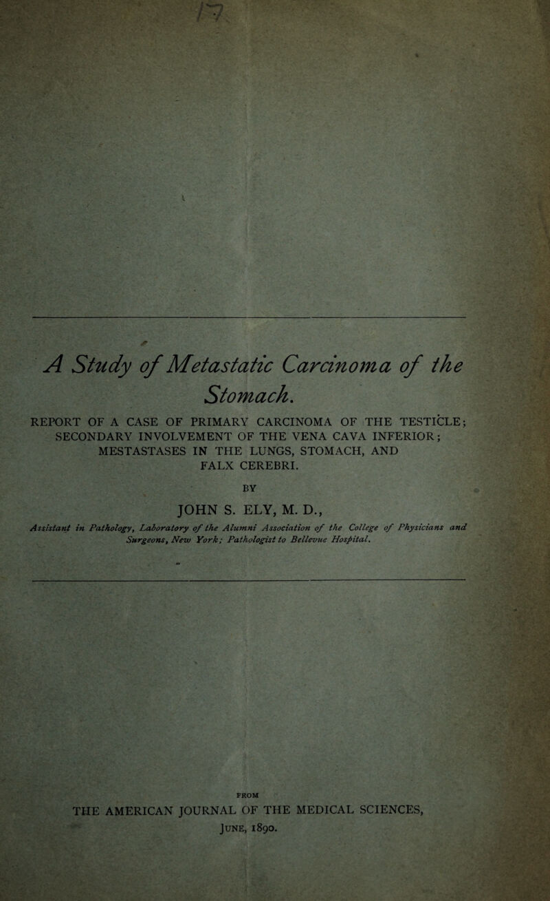 A Study of Metastatic Carcinoma of the Stomach. REPORT OF A CASE OF PRIMARY CARCINOMA OF THE TESTICLE; SECONDARY INVOLVEMENT OF THE VENA CAVA INFERIOR; MESTASTASES IN THE LUNGS, STOMACH, AND FALX CEREBRI. BY JOHN S. ELY, M. D., Assistant in Pathology, Laboratory of the Alumni Association of the College of Physicians and Surgeons, New York; Pathologist to Bellevue Hospital. FROM THE AMERICAN JOURNAL OF THE MEDICAL SCIENCES, June, 1890.