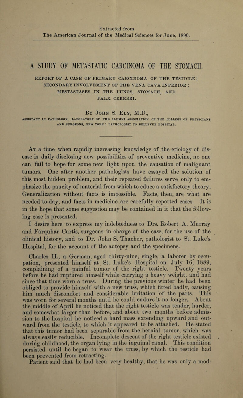 Extracted from The American Journal of the Medical Sciences for June, 1890. A STUDY OF METASTATIC CARCINOMA OF THE STOMACH. REPORT OF A CASE OF PRIMARY CARCINOMA OF THE TESTICLE ; SECONDARY INVOLVEMENT OF THE VENA CA VA INFERIOR ; MESTASTASES IN THE LUNGS, STOMACH, AND FALX CEREBRI. By John S. Ely, M.D., ASSISTANT IN PATHOLOGY, LABORATORY OF THE ALUMNI ASSOCIATION OF THE COLLEGE OF PHYSICIANS AND SURGEONS, NEW YORK ; PATHOLOGIST TO BELLEVUE HOSPITAL. At a time when rapidly increasing knowledge of the etiology of dis¬ ease is daily disclosing new possibilities of preventive medicine, no one can fail to hope for some new light upon the causation of malignant tumors. One after another pathologists have essayed the solution of this most hidden problem, and their repeated failures serve only to em¬ phasize the paucity of material from which to educe a satisfactory theory. Generalization without facts is impossible. Facts, then, are what are needed to-day, and facts in medicine are carefully reported cases. It is in the hope that some suggestion may be contained in it that the follow¬ ing case is presented. I desire here to express my indebtedness to Drs. Robert A. Murray and Farquhar Curtis, surgeons in charge of the case, for the use of the clinical history, and to Dr. John S. Thacher, pathologist to St. Luke’s Hospital, for the account of the autopsy and the specimens. Charles H., a German, aged thirty-nine, single, a laborer by occu¬ pation, presented himself at St. Luke’s Hospital on July 16, 1889, complaining of a painful tumor of the right testicle. Twenty years before he had ruptured himself while carrying a heavy weight, and had since that time worn a truss. During the previous winter he had been obliged to provide himself with a new truss, which fitted badly, causing him much discomfort and considerable irritation of the parts. This was worn for several months until he could endure it no longer. About the middle of April he noticed that the right testicle was tender, harder, and somewhat larger than before, and about two months before admis¬ sion to the hospital he noticed a hard mass extending upward and out¬ ward from the testicle, to which it appeared to be attached. He stated that this tumor had been separable from the hernial tumor, which was always easily reducible. Incomplete descent of the right testicle existed during childhood, the organ lying in the inguinal canal. This condition persisted until he began to wear the truss, by which the testicle had been prevented from retracting. Patient said that he had been very healthy, that he was only a mod-