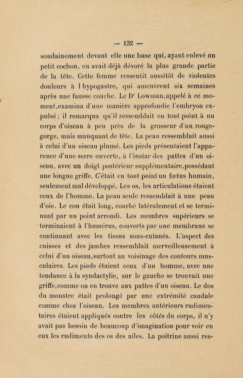 soudainement devant elle une buse qui, ayant enlevé un petit cochon, en avait déjà dévoré la plus grande partie de la tête. Cette femme ressentit aussitôt de violentes douleurs à 1 hypogastre, qui amenèrent six semaines après une fausse couche. Le Dr Lowman,appelé à ce mo¬ ment,examina d'une manière approfondie l’embryon ex¬ pulsé; il remarqua qu’il ressemblait en tout point à un corps d’oiseau à peu près de la grosseur d’un rouge- gorge, mais manquant de tête. La peau ressemblait aussi à celui d’un oiseau plumé. Les pieds présentaient l’appa¬ rence d’une serre ouverte, à l’instar des pattes d’un oi¬ seau, avec un doigt postérieur supplémentaire,possédant une lohgue griffe. C’était en tout point un fœtus humain, seulement mal développé. Les os, les articulations étaient ceux de l’homme. La peau seule ressemblait à une peau d’oie. Le cou était long, courbé latéralement et se termi¬ nant par un point arrondi. Les membres supérieurs se terminaient à l’humérus, couverts par une membrane se continuant avec les tissus sous-cutanés. L’aspect des cuisses et des jambes ressemblait merveilleusement à celui d’un oiseau,surtout au voisinage des contours mus¬ culaires. Les pieds étaient ceux d’un homme, avec une tendance à la syndactylie, sur le gauche se trouvait une griffe,comme on en trouve aux pattes d’un oiseau. Le dos du monstre était prolongé par une extrémité caudale comme chez l’oiseau. Les membres antérieurs rudimen¬ taires étaient appliqués contre les côtés du corps, il n’y avait pas besoin de beaucoup d’imagination pourvoir en eux les rudiments des os des ailes. La poitrine aussi res-