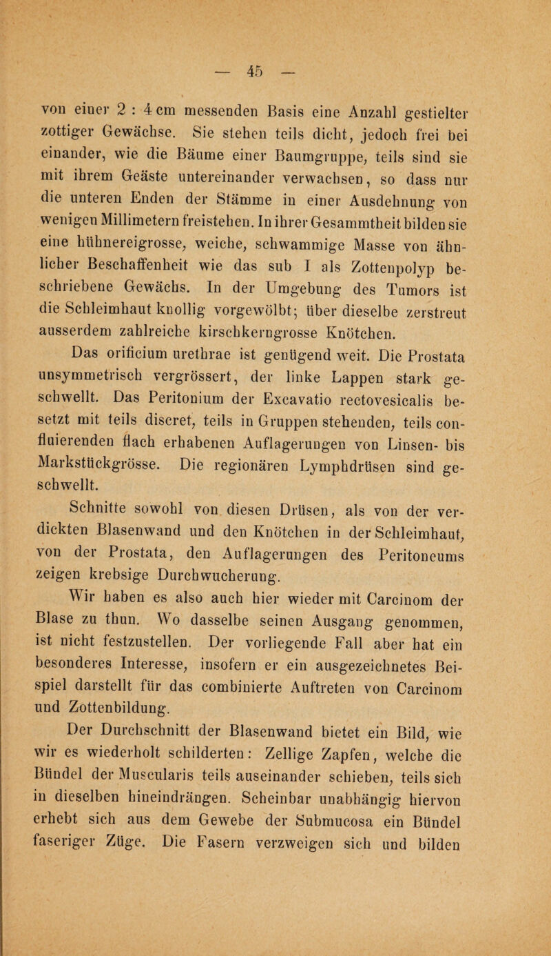 von einer 2 : 4 cm messenden Basis eine Anzahl gestielter zottiger Gewächse. Sie stehen teils dicht, jedoch frei bei einander, wie die Bäume einer Baumgruppe, teils sind sie mit ihrem Geäste untereinander verwachsen, so dass nur die unteren Enden der Stämme in einer Ausdehnung von wenigen Millimetern freistehen. In ihrer Gesammtheit bilden sie eine hühnereigrosse, weiche, schwammige Masse von ähn¬ licher Beschaffenheit wie das sub I als Zottenpolyp be¬ schriebene Gewächs. In der Umgebung des Tumors ist die Schleimhaut kuollig vorgewölbt; Überdieselbe zerstreut ausserdem zahlreiche kirschkerngrosse Knötchen. Das orificium urethrae ist genügend weit. Die Prostata unsymmetrisch vergrössert, der linke Lappen stark ge¬ schwellt. Das Peritoniiim der Excavatio rectovesicalis be¬ setzt mit teils discret, teils in Gruppen stehenden, teils con- fluierenden flach erhabenen Auflagerungen von Linsen- bis Markstückgrösse. Die regionären Lymphdrüsen sind ge¬ schwellt. Schnitte sowohl von diesen Drüsen, als von der ver¬ dickten Blasenwand und den Knötchen in der Schleimhaut, von der Prostata, den Auflagerungen des Peritoneums zeigen krebsige Durch Wucherung. Wir haben es also auch hier wieder mit Carcinom der Blase zu thun. Wo dasselbe seinen Ausgang genommen, ist nicht festzustellen. Der vorliegende Fall aber hat ein besonderes Interesse, insofern er ein ausgezeichnetes Bei¬ spiel darstellt für das combinierte Auftreten von Carcinom und Zottenbildung. Der Durchschnitt der Blasenwand bietet ein Bild, wie wir es wiederholt schilderten: Zeitige Zapfen, welche die Bündel der Muscularis teils auseinander schieben, teils sich in dieselben hineindrängen. Scheinbar unabhängig hiervon erhebt sich aus dem Gewebe der Submucosa ein Bündel faseriger Züge. Die Fasern verzweigen sich und bilden
