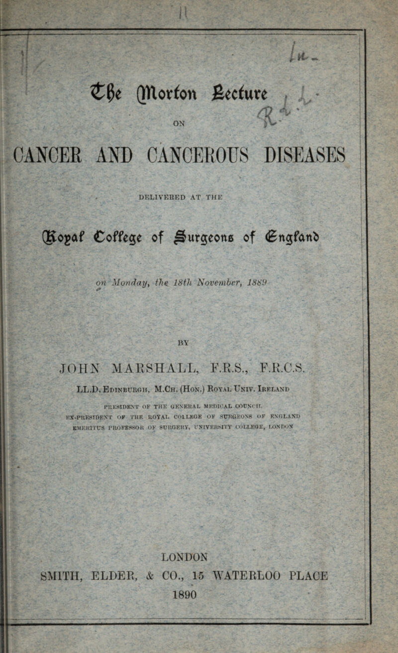 (JUorfon fkcfure ON CANCER AND CANCEROUS DISEASES DELIVERED AT THE (Kogaf Coffege of ^urgeone of dSngfcmfc on Monday, November, 1889 RY JOHN MARSHALL, F.R.S., F.R.O.S. LL.D. Edinburgh, M.Ch. (Hon.) Royal Univ. Ireland PRESIDENT OF THE GENERAL MEDICAL COUNCIL KX-PRESIDENT OF THE ROYAL COILF.GE OF SURGEONS OF ENGLAND EMERITUS PROFESSOR OF SURGERY, UNIVERSITY COLLEGE, LONDON* LONDON SMITH, ELDER, & CO., 15 WATERLOO PLACE 1890