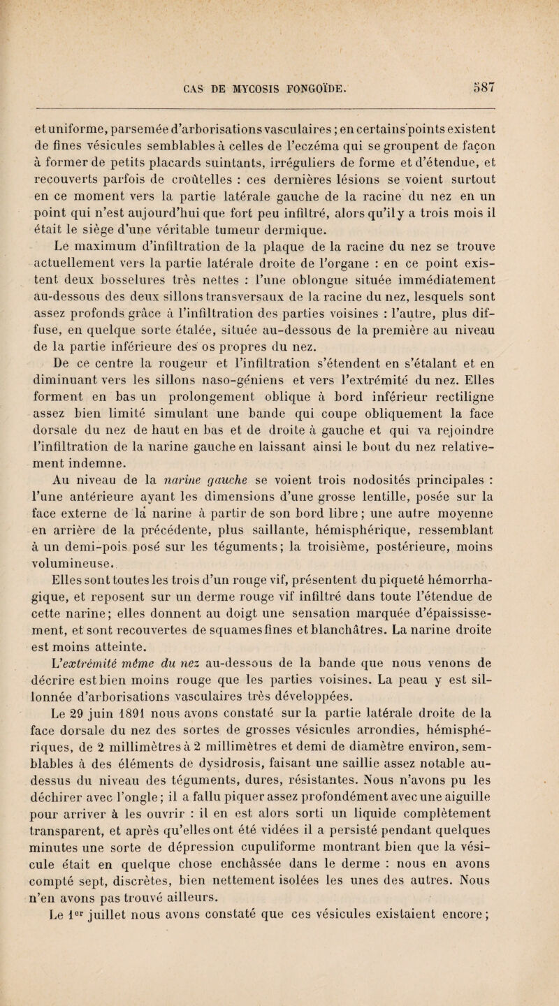 et uniforme, parsemée d’arborisations vasculaires ; en certains’points existent de fines vésicules semblables à celles de l’eczéma qui se groupent de façon à former de petits placards suintants, irréguliers de forme et d’étendue, et recouverts parfois de croûtelles : ces dernières lésions se voient surtout en ce moment vers la partie latérale gauche de la racine du nez en un point qui n’est aujourd’hui que fort peu infiltré, alors qu’il y a trois mois il était le siège d’une véritable tumeur dermique. Le maximum d’infiltration de la plaque de la racine du nez se trouve actuellement vers la partie latérale droite de l’organe : en ce point exis¬ tent deux bosselures très nettes : l’une oblongue située immédiatement au-dessous des deux sillons transversaux de la racine du nez, lesquels sont assez profonds grâce à l’infiltration des parties voisines : l’autre, plus dif¬ fuse, en quelque sorte étalée, située au-dessous de la première au niveau de la partie inférieure des os propres du nez. De ce centre la rougeur et l’infiltration s’étendent en s’étalant et en diminuant vers les sillons naso-géniens et vers l’extrémité du nez. Elles forment en bas un prolongement oblique à bord inférieur rectiligne assez bien limité simulant une bande qui coupe obliquement la face dorsale du nez de haut en bas et de droite à gauche et qui va rejoindre l’infiltration de la narine gauche en laissant ainsi le bout du nez relative¬ ment indemne. Au niveau de la narine gauche se voient trois nodosités principales : l’une antérieure ayant les dimensions d’une grosse lentille, posée sur la face externe de là narine à partir de son bord libre ; une autre moyenne en arrière de la précédente, plus saillante, hémisphérique, ressemblant à un demi-pois posé sur les téguments; la troisième, postérieure, moins volumineuse. Elles sont toutes les trois d’un rouge vif, présentent du piqueté hémorrha¬ gique, et reposent sur un derme rouge vif infiltré dans toute l’étendue de cette narine ; elles donnent au doigt une sensation marquée d’épaississe¬ ment, et sont recouvertes de squames fines et blanchâtres. La narine droite est moins atteinte. L'extrémité môme du nez au-dessous de la bande que nous venons de décrire est bien moins rouge que les parties voisines. La peau y est sil¬ lonnée d’arborisations vasculaires très développées. Le 29 juin 1891 nous avons constaté sur la partie latérale droite de la face dorsale du nez des sortes de grosses vésicules arrondies, hémisphé¬ riques, de 2 millimètres à 2 millimètres et demi de diamètre environ, sem¬ blables à des éléments de dysidrosis, faisant une saillie assez notable au- dessus du niveau des téguments, dures, résistantes. Nous n’avons pu les déchirer avec l’ongle ; il a fallu piquer assez profondément avec une aiguille pour arriver à les ouvrir : il en est alors sorti un liquide complètement transparent, et après qu’elles ont été vidées il a persisté pendant quelques minutes une sorte de dépression cupuliforme montrant bien que la vési¬ cule était en quelque chose enchâssée dans le derme : nous en avons compté sept, discrètes, bien nettement isolées les unes des autres. Nous n’en avons pas trouvé ailleurs. Le 1er juillet nous avons constaté que ces vésicules existaient encore;