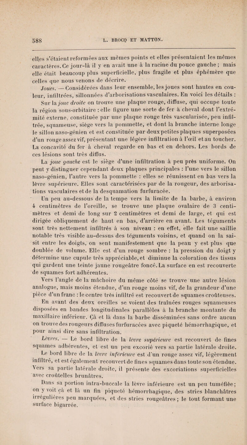 elles s’étaient reformées aux mêmes points et elles présentaient les mêmes caractères. Ce jour-là il y en avait une à la racine du pouce gauche ; mais elle était beaucoup plus superficielle, plus fragile et plus éphémère que celles que nous venons de décrire. Joues. —Considérées dans leur ensemble, les joues sont hautes en cou¬ leur, infiltrées, sillonnées d’arborisations vasculaires. En voici les détails : Sur la joue droite on trouve une plaque rouge, diffuse, qui occupe toute la région sous-orbitaire : elle figure une sorte de fer à cheval dont l’extré¬ mité externe, constituée par une plaque rouge très vascularisée, peu infil¬ trée, squameuse, siège vers la pommette, et dont la branche interne longe le sillon naso-génien et est constituée par deux petites plaques superposées d’un rouge assez vif, présentant une légère infiltration à l’œil et au toucher. La concavité du fer à cheval regarde en bas et en dehors. Les bords de ces lésions sont très diffus. La joue gauche est le siège d’une infiltration à peu près uniforme. On peut y distinguer cependant deux plaques principales : l’une vers le sillon naso-génien, l’autre vers la pommette : elles se réunissent en bas vers la lèvre supérieure. Elles sont caractérisées par de la rougeur, des arborisa¬ tions vasculaires et de la desquamation furfuracée. Un peu au-dessous de la tempe vers la limite de la barbe, à environ 4 centimètres de l’oreille, se trouve une plaque ovalaire de 3 centi¬ mètres et demi de long sur 2 centimètres et demi de large, et qui est dirigée obliquement de haut en bas, d’arrière en avant. Les téguments sont très nettement infiltrés à son niveau : en effet, elle fait une saillie notable très visible au-dessus des téguments voisins, et quand on la sai¬ sit entre les doigts, on sent manifestement que la peau y est plus que doublée de volume. Elle est d’un rouge sombre : la pression du doigt y détermine une cupule très appréciable, et diminue la coloration des tissus qui gardent une teinte jaune rougeâtre foncé. La surface en est recouverte de squames fort adhérentes. Vers l’angle de la mâchoire du même côté se trouve une autre lésion analogue, mais moins étendue, d’un rouge moins vif, de la grandeur d’une pièce d’un franc : le centre très infiltré est recouvert de squames croûteuses. En avant des deux oreilles se voient des traînées rouges squameuses disposées en bandes longitudinales parallèles à la branche montante du maxillaire inférieur. Çà et là dans la barbe disséminées sans ordre aucun on trouve des rougeurs diffuses furfuracées avec piqueté hémorrhagique, et pour ainsi dire sans infiltration. Lèvres. — Le bord libre de la lèvre supérieure est recouvert de fines squames adhérentes, et est un peu excorié vers sa partie latérale droite. Le bord libre de la lèvre inférieure est d’un rouge assez vif, légèrement infiltré, et est également recouvert de fines squames dans toute son étendue. Vers sa partie latérale droite, il présente des excoriations superficielles avec croùtelles brunâtres. Dans sa portion intra-buccale la lèvre inférieure est un peu tuméfiée; on y voit çà et la un fin piqueté hémorrhagique, des stries blanchâtres irrégulières peu marquées, et des stries rougeâtres ; le tout formant une surface bigarrée.