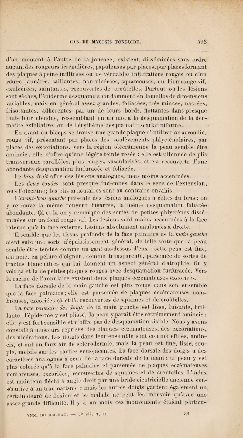 d’un moment à l’autre de la journée, existent, disséminées sans ordre aucun, des rougeurs irrégulières, papuleuses par places, par places formant des plaques à peine infiltrées ou de véritables infiltrations rouges ou d’un rouge jaunâtre, saillantes, non ulcérées, squameuses, ou bien rouge vif, exulcérées, suintantes, recouvertes de croùtelles. Partout où les lésions sont sèches, l’épiderme desquame abondamment en lamelles de dimensions variables, mais en général assez grandes, foliacées, très minces, nacrées, frisottantes, adhérentes par un de leurs bords, flottantes dans presque toute leur étendue, ressemblant en un mot à la desquamation de la der¬ matite exfoliative, ou de l’érythème desquamatif scarlatiniforme. En avant du biceps se trouve une grande plaque d’infiltration arrondie, rouge vif, présentant par places des soulèvements phlycténulaires, par places des excoriations. Vers la région olécranienne la peau semble être amincie; elle n’offre qu’une Jégère teinte rosée : elle est sillonnée de plis transversaux parallèles, plus rouges, vascularisés, et est recouverte d’une abondante desquamation furfuracée et foliacée. Le bras droit offre des lésions analogues, mais moins accentuées. Les deux coudes sont presque indemnes dans le sens de l’extension, vers l’olécrâne; les plis articulaires sont au contraire envahis. Vavant-bras gauche présente des lésions analogues à celles du bras : on y retrouve la même rougeur bigarrée, la même desquamation foliacée abondante. Çà et là on y remarque des sortes de petites phlyctènes dissé¬ minées sur un fond rouge vif. Les lésions sont moins accentuées à la face interne qu’à la face externe. Lésions absolument analogues à droite. Il semble que les tissus profonds de la face palmaire de la main gauche aient subi une sorte d’épaississement général, de telle sorte que la peau semble être tendue comme un gant au-dessus d’eux : cette peau est fine, amincie, en pelure d’oignon, comme transparente, parsemée de sortes de tractus blanchâtres qui lui donnent un aspect général d’atrophie. On y voit çà et là de petites plaques rouges avec desquamation furfuracée. Vers la racine de l’annulaire existent deux plaques eczémateuses excoriées. La face dorsale de la main gauche est plus rouge dans son ensemble que la face palmaire; elle est parsemée de plaques eczémateuses nom¬ breuses, excoriées çà et là, recouvertes de squames et de croùtelles. La face palmaire des doigts de la main gauche est lisse, luisante, bril¬ lante ; l’épiderme y est plissé, la peau y paraît être extrêmement amincie : elle y est fort sensible et n’offre pas de desquamation visible. Nous y avons constaté à plusieurs reprises des plaques eczémateuses, des excoriations, des ulcérations. Les doigts dans leur ensemble sont comme effilés, amin¬ cis, et ont un faux air de sclérodermie, mais la peau est fine, lisse, sou¬ ple, mobile sur les parties sous-jacentes. La face dorsale des doigts a des caractères analogues à ceux de la face dorsale de la main : la peau y est plus colorée qu’à la face palmaire et parsemée de plaques eczémateuses nombreuses, excoriées, recouvertes de squames et de croùtelles. L’index est maintenu fléchi à angle droit par une bride cicatricielle ancienne con¬ sécutive à un traumatisme : mais, les autres doigts gardent également un certain degré de flexion et le'malade ne peut les mouvoir qu’avec une assez grande difficulté. Il y a un mois ces mouvements étaient particu- VNN, DE DI5RMAT. — 3e Sic. T. II. 38