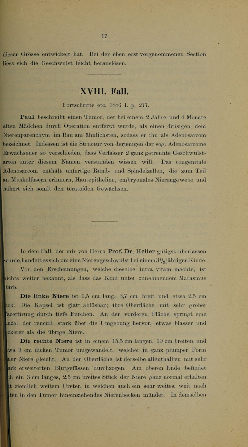 dieser Grösse entwickelt hat. Bei der eben erst vorgenommenen Section liess sich die Geschwulst leicht herauslösen. XVIII. Fall. Fortschritte etc. 1886 I. p. 277. Paul beschreibt einen Tumor, der bei einem 2 Jahre und 4 Monate alten Mädchen durch Operation entfernt wurde, als einen drüsigen, dem Nierenparenchym im Bau am ähnlichsten, sodass er ihn als Adenosarcom bezeichnet. Indessen ist die Structur von derjenigen der sog. Adenosarcome Erwachsener so verschieden, dass Verfasser 2 ganz getrennte Geschwulst¬ arten unter diesem Namen verstanden wissen will. Das congenitale Adenosarcom enthält unfertige Hund- und Spindelzellen, die zum Teil an Muskelfasern erinnern, Hautepithelien, embryonales Nierengewebe und nähert sich somit den teratoiden Gewächsen. In dem Fall, der mir von Herrn Prof. Dr. Heller gütigst überlassen rurde,handelt es sich um eine Nierengeschwulst bei einem8 Vg jährigenKinde. Von den Erscheinungen, welche dieselbe intra vitam machte, ist liclits weiter bekannt, als dass das Kind unter zunehmendem Marasmus Itarb. Die linke Niere ist 6,5 cm lang, 3,7 cm breit und etwa 2,5 cm lick. Die Kapsel ist glatt ablösbar; ihre Oberfläche mit sehr grober racettirung durch tiefe Furchen. An der vorderen Fläche springt eine lzal der renculi stark über die Umgebung hervor, etwas blasser und (»ckerer als die übrige Niere. Die rechte Niere ist in einem 15,5 cm langen, 10 cm breiten und iwa 9 cm dicken Tumor umgewandelt, welcher in ganz plumper Form 1er Niere gleicht. An der Oberfläche ist derselbe allenthalben mit sehr irk erweiterten Blutgefässen durchzogen. Am oberen Ende befindet fli ein 3 cm langes, 2,5 cm breites Stück der Niere ganz normal erhalten lt ziemlich weitem Ureter, in welchen auch ein sehr weites, weit nach Lten in den Tumor hineinziehendes Nierenbecken mündet. In demselben