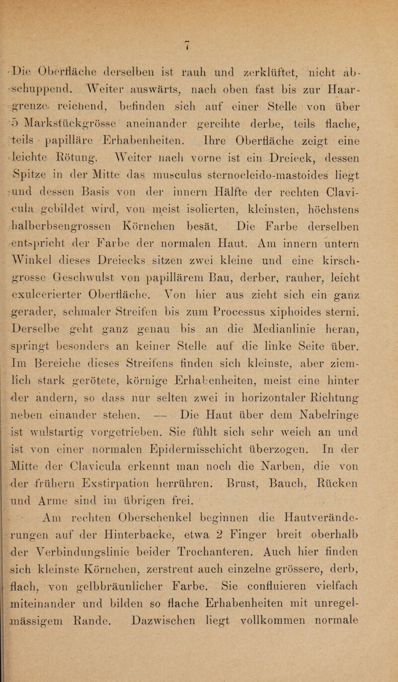 I Die Oberfläche derselben ist rauh und zerklüftet, nicht ab- -schuppend. Weiter auswärts, nach oben fast bis zur Haar¬ grenze. reichend, befinden sich auf einer Stelle von über o Markstückgrösse aneinander gereihte derbe, teils flache, teils papilläre Erhabenheiten. Ihre Oberfläche zeigt eine leichte Rötung. Weiter nach vorne ist ein Dreieck, dessen Spitze in der Mitte das musculus sternocleido-mastoides liegt und dessen Basis von der innern Hälfte der rechten Clavi- •cula gebildet wird, von meist isolierten, kleinsten, höchstens halberbsengrossen Körnchen besät. Die Farbe derselben entspricht der Farbe der normalen Haut,, Am innern untern Winkel dieses Dreiecks sitzen zwei kleine und eine kirsch¬ grosse Geschwulst von papillärem Bau, derber, rauher, leicht exulcerierter Oberfläche. Von hier aus zieht sich ein ganz gerader, schmaler Streifen bis zum Processus xiphoides sterni. Derselbe geht ganz genau bis an die Medianlinie heran, springt besonders an keiner Stelle auf die linke Seite über. Im Bereiche dieses Streifens finden sich kleinste, aber ziem¬ lich stark gerötete, körnige Erhabenheiten, meist eine hinter der andern, so dass nur selten zwei in horizontaler Richtung neben einander stehen. — Die Haut über dem Nabelringe ist wulstartig vorgetrieben. Sie fühlt sich sehr weich an und ist von einer normalen Epidermisschicht überzogen. In der Mitte der Clavicula erkennt man noch die Narben, die von der frühem Exstirpation herrühren. Brust, Bauch, Rücken und Arme sind im übrigen frei. Am rechten Oberschenkel beginnen die Hautverände¬ rungen auf der Hinterbacke, etwa 2 Finger breit oberhalb der Verbindungslinie beider Trochanteren. Auch hier finden sich kleinste Körnchen, zerstreut auch einzelne grössere, derb, flach, von gelbbräunlicher Farbe. Sie confluieren vielfach miteinander und bilden so flache Erhabenheiten mit unregel¬ mässigem Rande. Dazwischen liegt vollkommen normale
