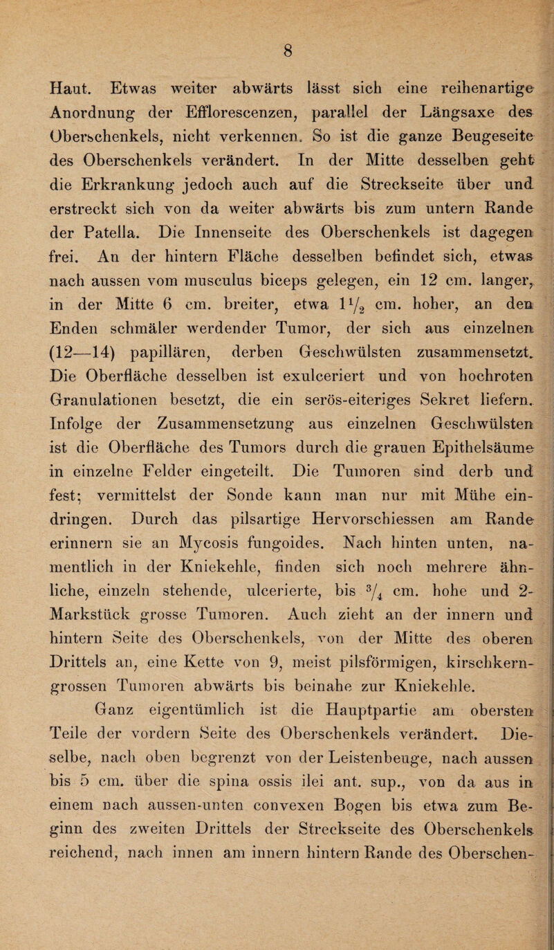 Haut. Etwas weiter abwärts lässt sich eine reihenartige Anordnung der Efflorescenzen, parallel der Längsaxe des Oberschenkels, nicht verkennen. So ist die ganze Beugeseite des Oberschenkels verändert. In der Mitte desselben geht die Erkrankung jedoch auch auf die Streckseite über und erstreckt sich von da weiter abwärts bis zum untern Rande der Patella. Die Innenseite des Oberschenkels ist dagegen frei. An der hintern Fläche desselben befindet sich, etwas nach aussen vom musculus biceps gelegen, ein 12 cm. langer, in der Mitte 6 cm. breiter, etwa 11/2 cm. hoher, an den Enden schmäler werdender Tumor, der sich aus einzelnen (12—14) papillären, derben Geschwülsten zusammensetzt. Die Oberfläche desselben ist exulceriert und von hochroten Granulationen besetzt, die ein serös-eiteriges Sekret liefern. Infolge der Zusammensetzung aus einzelnen Geschwülsten ist die Oberfläche des Tumors durch die grauen Epithelsäume in einzelne Felder eingeteilt. Die Tumoren sind derb und fest; vermittelst der Sonde kann man nur mit Mühe ein- dringen. Durch das pilsartige Hervorschiessen am Rande erinnern sie an Myeosis fungoides. Nach hinten unten, na¬ mentlich in der Kniekehle, finden sich noch mehrere ähn¬ liche, einzeln stehende, ulcerierte, bis 3/4 cm. hohe und 2- Markstück grosse Tumoren. Auch zieht an der innern und hintern Seite des Oberschenkels, von der Mitte des oberen Drittels au, eine Kette von 9, meist pilsförmigen, kirschkern¬ grossen Tumoren abwärts bis beinahe zur Kniekehle. Ganz eigentümlich ist die Hauptpartie am obersten Teile der vordem Seite des Oberschenkels verändert. Die¬ selbe, nach oben begrenzt von der Leistenbeuge, nach aussen bis 5 cm. über die spina ossis ilei ant. sup., von da aus in einem nach aussen-unten convexen Bogen bis etwa zum Be¬ ginn des zweiten Drittels der Streckseite des Oberschenkeln reichend, nach innen am innern hintern Rande des Oberschen-