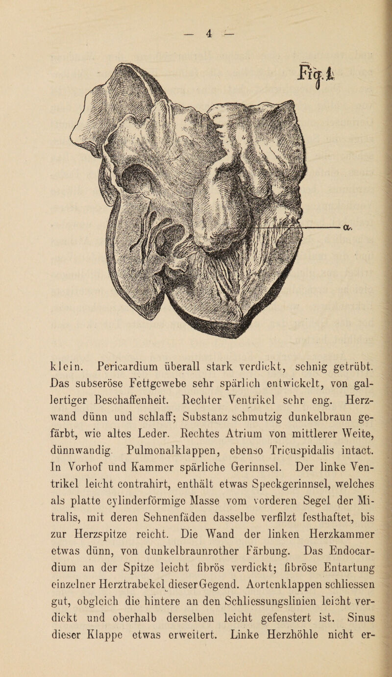 klein. Pericardium überall stark verdickt, sehnig getrübt. Das subseröse Fettgewebe sehr spärlich entwickelt, von gal¬ lertiger Beschaffenheit. Rechter Ventrikel sehr eng. Herz¬ wand dünn und schlaff; Substanz schmutzig dunkelbraun ge¬ färbt, wie altes Leder. Rechtes Atrium von mittlerer Weite, dünnwandig. Pulmonal klappen, ebenso Tricuspidalis intact. In Vorhof und Kammer spärliche Gerinnsel. Der linke Ven¬ trikel leicht contrahirt, enthält etwas Speckgerinnsel, welches als platte cylinderförmige Masse vom vorderen Segel der Mi¬ tralis, mit deren Sehnenfäden dasselbe verfilzt festhaftet, bis zur Herzspitze reicht. Die Wand der linken Herzkammer etwas dünn, von dunkelbraunrother Färbung. Das Endocar- dium an der Spitze leicht fibrös verdickt; fibröse Entartung einzelner Herztrabekel dieser Gegend. Aortenklappen schliessen gut, obgleich die hintere an den Schlicssungslinien leicht ver¬ dickt und oberhalb derselben leicht gefenstert ist. Sinus dieser Klappe etwas erweitert. Linke Herzhöhle nicht er-