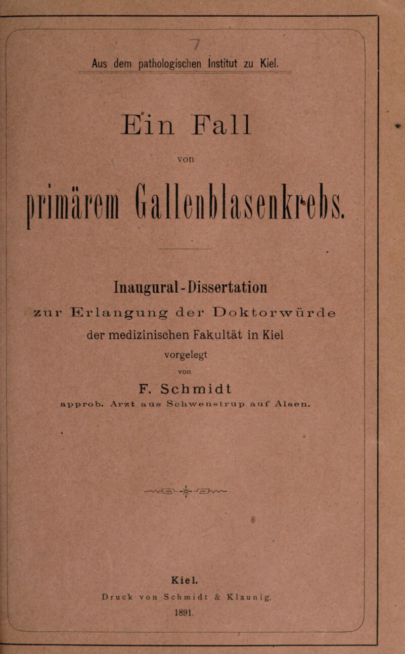 7 Aus dem pathologischen Institut zu Kiel. E'in Fall von jriiilireiii Gallenllaseiilrelis. Inaiigural - Dissertation zur Erlangung der Doktorwürde der medizinisehen Fakultät in Kiel vorgelegt von F. Schmidt approb. Ar55t aus Scbwenstrup auf Alsen. Kiel. Druck von Schmidt & Klaunig. 1891.