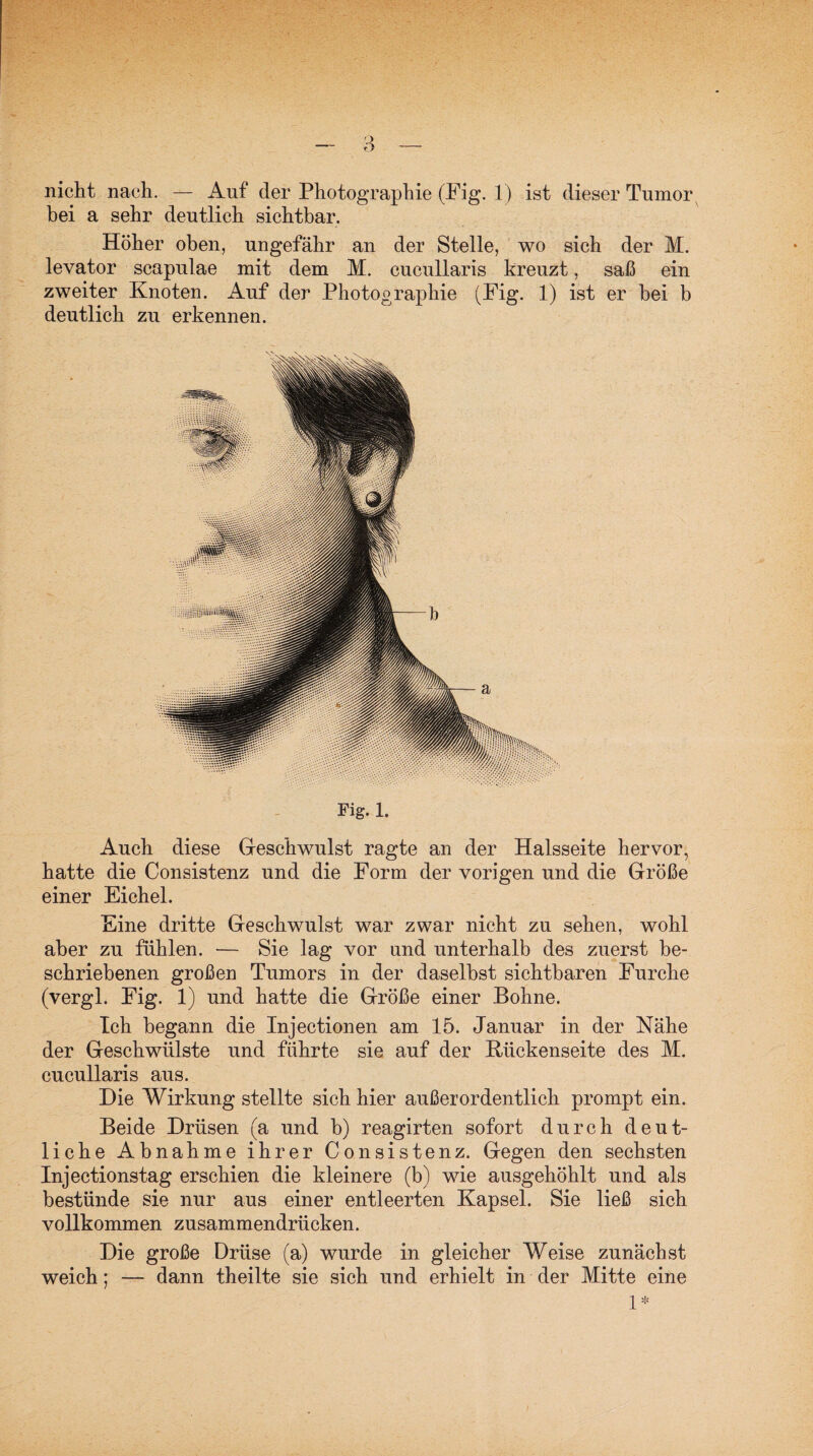 nicht nach. — Auf der Photographie (Fig. 1) ist dieser Tumor bei a sehr deutlich sichtbar. Höher oben, ungefähr an der Stelle, wo sich der M. levator scapulae mit dem M. cucullaris kreuzt, saß ein zweiter Knoten. Auf der Photographie (Fig. 1) ist er bei b deutlich zu erkennen. Fig. 1. Auch diese Geschwulst ragte an der Halsseite hervor, hatte die Consistenz und die Form der vorigen und die Größe einer Eichel. Eine dritte Geschwulst war zwar nicht zu sehen, wohl aber zu fühlen. ■— Sie lag vor und unterhalb des zuerst be¬ schriebenen großen Tumors in der daselbst sichtbaren Furche (vergl. Fig. 1) und hatte die Größe einer Bohne. Ich begann die Injectionen am 15. Januar in der Nähe der Geschwülste und führte sie auf der Kückenseite des M. cucullaris aus. Die Wirkung stellte sich hier außerordentlich prompt ein. Beide Drüsen (a und b) reagirten sofort durch deut¬ liche Abnahme ihrer Consistenz. Gegen den sechsten Injectionstag erschien die kleinere (b) wie ausgehöhlt und als bestünde sie nur aus einer entleerten Kapsel. Sie ließ sich vollkommen zusammendrücken. Die große Drüse (a) wurde in gleicher Weise zunächst weich; — dann theilte sie sich und erhielt in der Mitte eine 1*