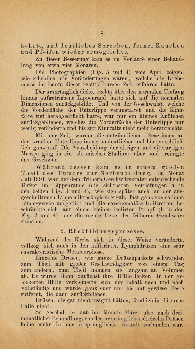 kehrte, und deutliches Sprechen, ferner Rauchen und Pfeifen wieder ermöglichte. Zu dieser Besserung kam es im Verlaufe einer Behand¬ lung von etwa vier Monaten. Die Photographien (Fig. 3 und 4) vom April zeigen, wie erheblich die Veränderungen waren, welche die Krebs¬ masse im Laufe dieser relativ kurzen Zeit erfahren hatte. Der ursprünglich dicke, rechts über den normalen Umfang hinaus aufgetriebene Lippenrand hatte sich auf die normalen Dimensionen zurückgebildet. Und von der Geschwulst, welche die Vorderfläche der Unterlippe verunstaltet und die Kinn¬ falte tief herabgedrückt hatte, war nur ein kleines Knötchen zurückgeblieben, welches die Vorderfläche der Unterlippe nur wenig veränderte und bis zur Kinnfalte nicht mehr heranreichte. Mit der Zeit wurden die entzündlichen Reactionen an der kranken Unterlippe immer undeutlicher und hörten schließ¬ lich ganz auf. Die Ausscheidung der eitrigen und eiterartigen Massen ging in ein chronisches Stadium über und reinigte das Geschwür. Während dessen kam es in einem großen Tlieil des Tumors zur Narbenbildüng. Im Monat Juli 1891 war der dem frühem Geschwürskrater entsprechende Defect im Lippenrande (die sichtbaren Vertiefungen a in den beiden Fig. 3 und 4), wie sich später auch an der aus¬ geschnittenen Lippe mikroskopisch ergab, fast ganz von solidem Bindegewebe ausgefüllt und die carcinomatöse Infiltration be¬ schränkte sich auf einen kleinen isolirten Pfropf (b in den Fig. 3 und 4) , der die rechte Ecke des früheren Geschwürs einnahm. 2. Rückbildungsprocesse. Während der Krebs sich in dieser Weise veränderte, vollzog sich auch in den infiltrirten Lymphdrüsen eine sehr charakteristische Metamorphose. Einzelne Drüsen, wie ganze Drüsenpackete schwanden zum Theil mit großer Geschwindigkeit von einem Tag zum andern, zum Theil nahmen sie langsam an Volumen ab. Es wurde dann zunächst ihre Hülle locker. In der ge¬ lockerten Hülle verkleinerte sich der Inhalt nach und nach vollständig und wurde ganz oder nur bis auf gewisse Reste entfernt, die dann zurückblieben. Drüsen, die gar nicht reagirt hätten, fand ich in diesem Falle nicht. So geschah es, daß im Monate März, also nach drei¬ monatlicher Behandlung, von den ursprünglichen dreizehn Drüsen keine mehr in der ursprünglichen Gestalt vorhanden war.