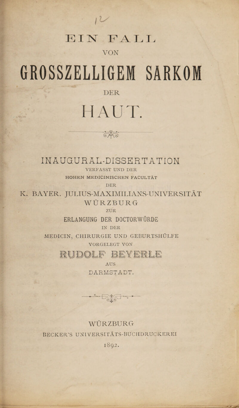 EIN FALL VON GROSSZELLIGEM SARKOM DER H A U T. IN AUGUR AL-DISSERTATION VERFASST UND DER HOHEN MEDICINISCHEN FACULTÄT DER Iv. BAYER. JULIUS-MAXIMILIANS-UNIVERSITÄT WÜRZBURG ZUR ERLANGUNG DER DOCTORWURDE IN DER MEDICIN, CHIRURGIE UND GEBURTSHÜLFE VORGELEGT VON AUS DARMSTADT. WÜRZBURG BECKER'S UNtVERSITÄTS-BUCHDRUCKEREI 1892.