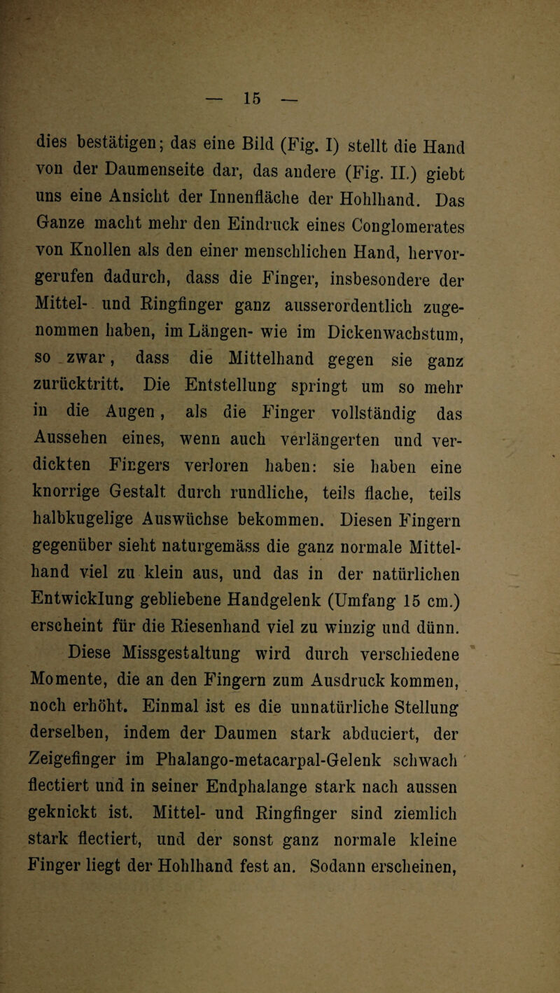 dies bestätigen; das eine Bild (Fig. I) stellt die Hand von der Daumenseite dar, das andere (Fig. II.) giebt uns eine Ansicht der Innenfläche der Hohlhand. Das Ganze macht mehr den Eindruck eines Conglomerates von Knollen als den einer menschlichen Hand, hervor¬ gerufen dadurch, dass die Finger, insbesondere der Mittel- und Ringfinger ganz ausserordentlich zuge¬ nommen haben, im Längen- wie im Dickenwachstum, so zwar, dass die Mittelhand gegen sie ganz zurücktritt. Die Entstellung springt um so mehr in die Augen, als die Finger vollständig das Aussehen eines, wenn auch verlängerten und ver¬ dickten Fingers verloren haben: sie haben eine knorrige Gestalt durch rundliche, teils flache, teils halbkugelige Auswüchse bekommen. Diesen Fingern gegenüber sieht naturgemäss die ganz normale Mittel¬ hand viel zu klein aus, und das in der natürlichen Entwicklung gebliebene Handgelenk (Umfang 15 cm.) erscheint für die Riesenhand viel zu winzig und dünn. Diese Missgestaltung wird durch verschiedene Momente, die an den Fingern zum Ausdruck kommen, noch erhöht. Einmal ist es die unnatürliche Stellung derselben, indem der Daumen stark abduciert, der Zeigefinger im Phalango-metacarpal-Gelenk schwach flectiert und in seiner Endphalange stark nach aussen geknickt ist. Mittel- und Ringfinger sind ziemlich stark flectiert, und der sonst ganz normale kleine Finger liegt der Hohlhand fest an. Sodann erscheinen,