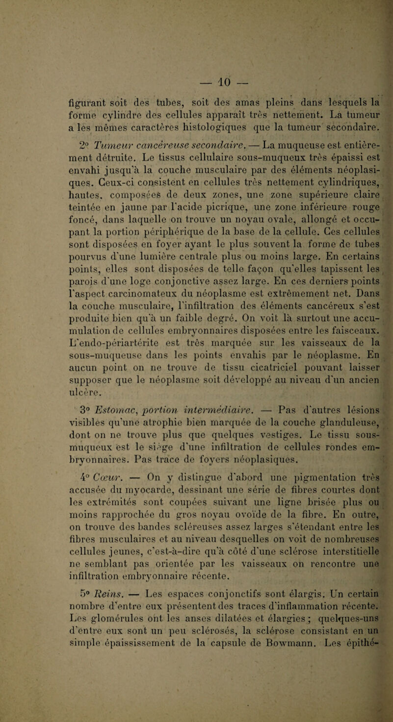 » m * ' J figurant soit des tubes, soit des amas pleins dans lesquels la forme cylindre des cellules apparait tros nettement. La tumeur a les memes caracteres histologiques que la tumeur secondaire. 2° Tumeur cancereuse secondaire. — La muqueuse est entiere- ment detruite. Le tissus cellulaire sous-muqueux tres epaissi est envahi jusqu’a la couche musculaire par des elements neoplasi- ques. Geux-ci consistent en cellules tres nettement cylindriques, hautes, composees de deux zones, une zone superieure claire teintee en jaune par l'acide picrique, une zone inferieure rouge fonce, dans laquelle on trouve un noyau ovale, allonge et occu¬ pant la portion peripherique de la base de la cellule. Ges cellules sont disposees en foyer ayant le plus souvent la forme de tubes pourvus d'une lumiere centrale plus ou moins large. En certains points, elles sont disposees de telle fa^on qu'elles tapissent les parois d'une loge conjonctive assez large. En ces derniers points Laspect carcinomateux du neoplasme est extremement net. Dans la couche musculaire, l'infiltration des elements cancereux s’est produite bien qu'a un faible degre. On voit la surtout une accu¬ mulation de cellules embryonnaires disposees entre les faisceaux. L'endo-periarterite est tres marquee sur les vaisseaux de la sous-muqueuse dans les points envahis par le neoplasme. En aucun point on ne trouve de tissu cicatriciel pouvant laisser supposer que le neoplasme soit developpe au niveau d'un ancien ulcere. 3° Estomac, portion intermediaire. — Pas d'autres lesions visibles qu'une atrophie bien marquee de la couche glanduleuse, dont on ne trouve plus que quelques vestiges. Le tissu sous- muqueux est le siege d'une infiltration de cellules rondes em¬ bryonnaires. Pas trace de foyers neoplasiques. 4° Coeur. — On y distingue d'abord une pigmentation tres accusee du myocarde, dessinant une serie de fibres courtes dont les extremites sont coupees suivant une ligne brisee plus ou moins rapprochee du gros noyau ovoide de la fibre. En outre, on trouve des bandes sclereuses assez larges s’etendant entre les fibres musculaires et au niveau desquelles on voit de nombreuses cellules jeunes, c’est-a-dire qu'a cote d'une sclerose interstitielle ne semblant pas orientee par les vaisseaux on rencontre une infiltration embryonnaire recente. 5° Reins. — Les espaces conjonctifs sont elargis. Un certain nombre d’entre eux presentent des traces d'inflammation recente. Les glomerules ont les anses dilatees et elargies; quelques-uns d’entre eux sont un pen scleroses, la sclerose consistent en un simple epaississement de la capsule de Bowmann. Les epithe-