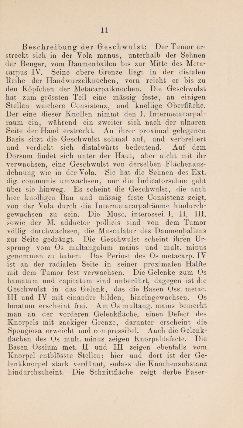 Beschreibung der Geschwulst: Der Tumor er¬ streckt sich in der Vola manus, unterhalb der Sehnen der Beuger, vom Daumenballen bis zur Mitte des Meta- carpus IY. Seine obere Grenze liegt in der distalen Beihe der Handwurzelknochen, vorn reicht er bis zu den Köpfchen der Metacarpalknochen. Die Geschwulst hat zum grössten Teil eine massig feste, an einigen Stellen weichere Consistenz, und knollige Oberfläche. Der eine dieser Knollen nimmt den I. Xntermetacarpal- raum ein, während ein zweiter sich nach der ulnaren Seite der Hand erstreckt. An ihrer proximal gelegenen Basis sitzt die Geschwulst schmal auf, und verbreitert und verdickt sich distalwärts bedeutend. Auf dem Dorsurn findet sich unter der Haut, aber nicht mit ihr verwachsen, eine Geschwulst von derselben Flächenaus¬ dehnung wie in der Yola. Sie bat die Sehnen des Ext. dig. communis umwachsen, nur die Xndicatorsehne geht über sie hinweg. Es scheint die Geschwulst, die auch hier knolligen Bau und mässig feste Consistenz zeigt, von der Yola durch die Intermetacarpalräume hindurch¬ gewachsen zu sein. Die Muse, interossei I, XX, III, sowie der M. adductor pollicis sind von dem Tumor völlig durchwachsen, die Musculatur des Daumenballens zur Seite gedrängt. Die Geschwulst scheint ihren Ur¬ sprung vom Os multangulum maius und mult. minus genommen zu haben. Das Periost des Os metacarp. XY ist an der radialen Seite in seiner proximalen Hälfte mit dem Tumor fest verwachsen. Die Gelenke zum Os hamatum und capitatum sind unberührt, dagegen ist die Geschwuilst in das Gelenk, das die Basen Oss. metac. III und IV mit einander bilden, hineingewachsen. Os lunatum erscheint frei. Am Os multang. maius bemerkt man an der vorderen Gelenkfläche, einen Defect des Knorpels mit zackiger Grenze, darunter erscheint die Spongiosa erweicht und compressihel. Auch die Gelenk¬ flächen des Os mult. minus zeigen Knorpeldefecte. Die Basen Ossium met. II und III zeigen ebenfalls vom Knorpel entblösste Stellen; hier und dort ist der Ge¬ lenkknorpel stark verdünnt, sodass die Knochensubstanz hindurchscheint. Die Schnittfläche zeigt derbe Faser-