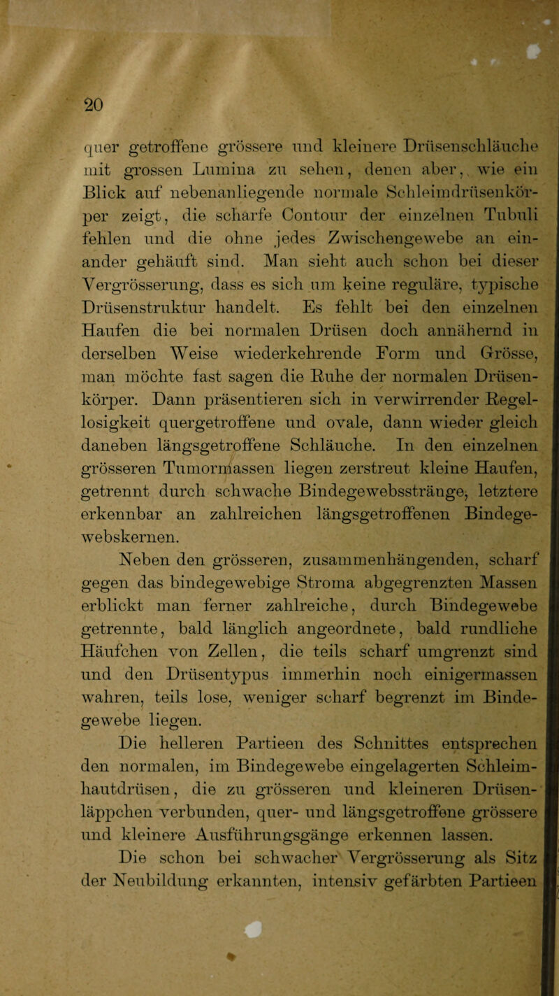 quer getroffene grössere und kleinere Drüsenschläuche mit grossen Lumina zu sehen, denen aber, wie ein Blick auf nebenanliegende normale Schleimdrüsenkör¬ per zeigt, die scharfe Contour der einzelnen Tubuli fehlen und die ohne jedes Zwischengewebe an ein¬ ander gehäuft sind. Man sieht auch schon bei dieser Vergrösserung, dass es sich um keine reguläre, typische Drüsenstruktur handelt. Es fehlt bei den einzelnen Haufen die bei normalen Drüsen doch annähernd in derselben Weise wiederkehrende Form und Grösse, man möchte fast sagen die Ruhe der normalen Drüsen¬ körper. Dann präsentieren sich in verwirrender Regel¬ losigkeit quergetroffene und ovale, dann wieder gleich daneben längsgetroffene Schläuche. In den einzelnen grösseren Tumormassen liegen zerstreut kleine Haufen, getrennt durch schwache Bindegewebsstränge, letztere erkennbar an zahlreichen längsgetroffenen Bindege- webskernen. Neben den grösseren, zusammenhängenden, scharf I gegen das bindegewebige Stroma abgegrenzten Massen erblickt man ferner zahlreiche, durch Bindegewebe getrennte, bald länglich angeordnete, bald rundliche Häufchen von Zellen, die teils scharf umgrenzt sind i und den Drüsentypus immerhin noch einigermassen j wahren, teils lose, weniger scharf begrenzt im Binde- I gewebe liegen. Die helleren Partieen des Schnittes entsprechen den normalen, im Bindegewebe eingelagerten Schleim¬ hautdrüsen , die zu grösseren und kleineren Drüsen¬ läppchen verbunden, quer- und längsgetroffene grössere I und kleinere Ausführungsgänge erkennen lassen. Die schon bei schwacher Vergrösserung als Sitz I der Neubildung erkannten, intensiv gefärbten Partieen H.