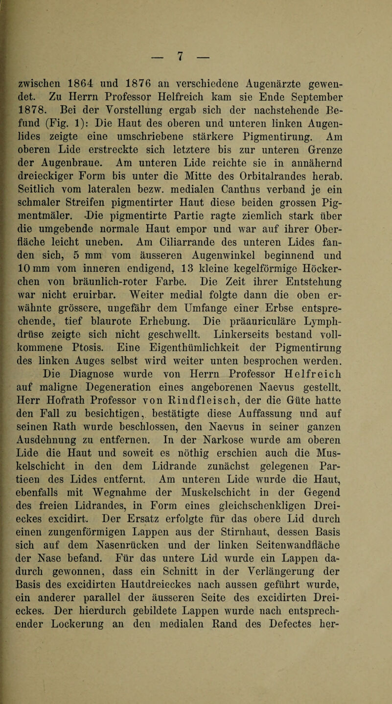 zwischen 1864 und 1876 an verschiedene Augenärzte gewen¬ det. Zu Herrn Professor Helfreich kam sie Ende September 1878. Bei der Vorstellung ergab sich der nachstehende Be¬ fund (Fig. 1): Die Haut des oberen und unteren linken Augen¬ lides zeigte eine umschriebene stärkere Pigmentirung. Am oberen Lide erstreckte sich letztere bis zur unteren Grenze der Augenbraue. Am unteren Lide reichte sie in annähernd dreieckiger Form bis unter die Mitte des Orbitalrandes herab. Seitlich vom lateralen hezw. medialen Canthus verband je ein schmaler Streifen pigmentirter Haut diese beiden grossen Pig- mentmäler. -Die pigmentirte Partie ragte ziemlich stark über die umgebende normale Haut empor und war auf ihrer Ober¬ fläche leicht uneben. Am Ciliarrande des unteren Lides fan¬ den sich, 5 mm vom äusseren Augenwinkel beginnend und 10 mm vom inneren endigend, 13 kleine kegelförmige Höcker- chen von bräunlich-roter Farbe. Die Zeit ihrer Entstehung war nicht eruirhar. Weiter medial folgte dann die oben er¬ wähnte grössere, ungefähr dem Umfange einer Erbse entspre¬ chende, tief blaurote Erhebung. Die präauriculäre Lymph- drüse zeigte sich nicht geschwellt. Linkerseits bestand voll¬ kommene Ptosis. Eine Eigenthümlichkeit der Pigmentirung des linken Auges selbst wird weiter unten besprochen werden. Die Diagnose wurde von Herrn Professor Helfreich auf maligne Degeneration eines angeborenen Naevus gestellt. Herr Hofrath Professor von Rindfleisch, der die Güte hatte den Fall zu besichtigen, bestätigte diese Auffassung und auf seinen Rath wurde beschlossen, den Naevus in seiner ganzen Ausdehnung zu entfernen. In der Narkose wurde am oberen Lide die Haut und soweit es nöthig erschien auch die Mus¬ kelschicht in den dem Lidrande zunächst gelegenen Par- tieen des Lides entfernt. Am unteren Lide wurde die Haut, ebenfalls mit Wegnahme der Muskelschicht in der Gegend des freien Lidrandes, in Form eines gleichschenkligen Drei¬ eckes excidirt. Der Ersatz erfolgte für das obere Lid durch einen zungenförmigen Lappen aus der Stirnhaut, dessen Basis sich auf dem Nasenrücken und der linken Seitenwandfläche der Nase befand. Für das untere Lid wurde ein Lappen da¬ durch gewonnen, dass ein Schnitt in der Verlängerung der Basis des excidirten Hautdreieckes nach aussen geführt wurde, ein anderer parallel der äusseren Seite des excidirten Drei¬ eckes. Der hierdurch gebildete Lappen wurde nach entsprech¬ ender Lockerung an den medialen Rand des Defectes her-