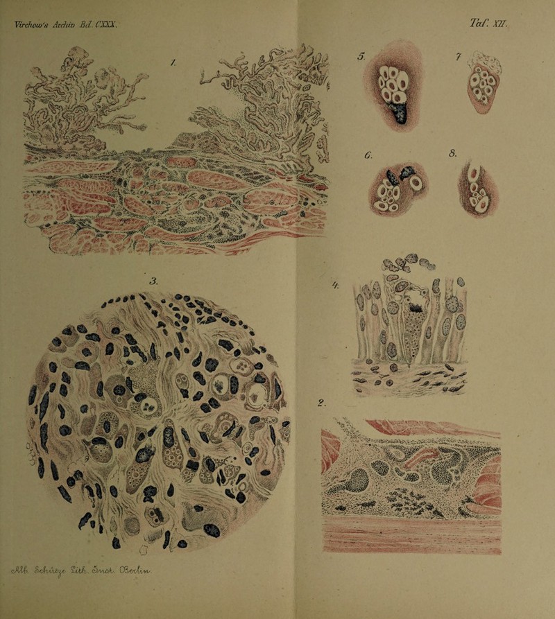 Yirchouj's Archiv Bel. CXXX. Taf. X7L {£&. «• .oi* v?; •■ • ..• - — .. •' ,tirA- ' '■> cAÄ%>. <§/SUkh . CJaaöY. Cß/fytiiVL/■