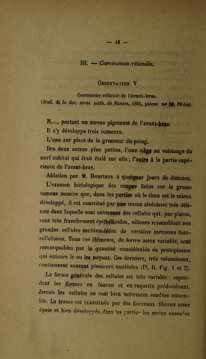 / III. — Carcinomes réticulés. Observation V I J . > ■ r'j X ^ . . * ’ . \ Carcinome réticulé de Pavani-bras. {Bull, de la Soc. anat. path. de Nantes, 1881, pièces n*» 59, 59 bü). N..., portant un nævus pigmenté de l’avant-bfas. Il s’y développe trois tumeurs. L’une sur place de la grosseur du poing. Des deux autres plus petites, l’une siège au voisinage du nerf cubital qui était étalé sur elle ; l’autre à la partie supé¬ rieure de l’avanf-brns. Ablation par M. Heurtaux à quelques jours de distance. L’examen histologique des coupes faites sur la grosse tumeur montre que, dans les parties où le tissu est le mieux développé, il est constitué par une trame alvéolaire très déli¬ cate dans laquelle sont contenues des cellules qui, par places, sont très franchement épithélioïdes, ailleurs ressemblent aux grandes cel ules multinucléées de certains sarcomes fuso- cellulaires. Tous ces éléments, de forme assez variable, sont remarquables par la quantité considérable de protoplasma qui entoure le ou les noyaux. Ces derniers, très volumineux, contiennent souvent plusieurs nucléoles (PI. II. Fig. 1 et 2). La forme générale des cellules est très variable : cepen¬ dant les formes en fuseau et en raquette prédominent. Jamais les cellules ne sont bien nettement soudées ensem¬ ble. La trame est constituée par des faisceaux fibreux assez épais et bien développés dans 'es partie* les moins avancées